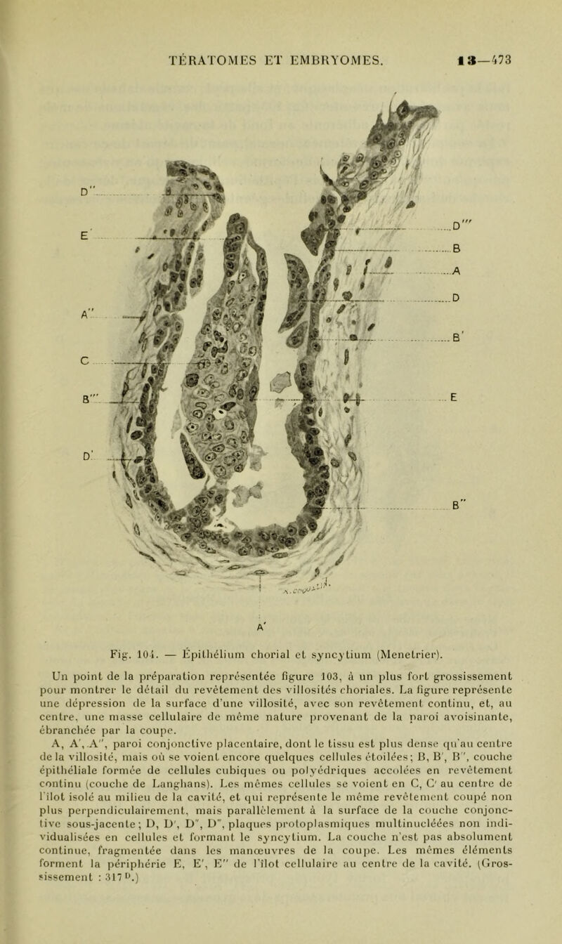 TÉRATOMES ET EMBRYOMES. i»—473 a' Fig. 10-i. — Épilliélium chorial cl syncytium (Menetrier). Un point de la préparation représentée figure 103, à un plus fort grossissement pour montrer le détail du revêtement des villosités choriales. La figure représente une dépression de la surface d'une villosité, avec son revêtement continu, et, au centre, une masse cellulaire de même nature provenant de la paroi avoisinante, ébranchée par la coupe. A, A',.A, paroi conjonctive placentaire, dont le tissu est plus dense ciu'au centre de la villosité, mais où se voient encore quelques cellules étoilées; B, B', H ', couche épithéliale formée de cellules cubiques ou polyédriques accolées en revêtement continu (couche de Langhans). Les mêmes cellules se voient en C, G' au centre de l'ilot isolé au milieu de la cavité, et qui représente le même revêtement coupé non plus perpendiculairement, mais parallèlement à la surface de la couche conjonc- tive sous-jacente; U, D', D, L)”, plaques protoplasmiques multinucléées non indi- vidualisées en cellules et formant le syncytium. La couche n'est pas absolument continue, fragmentée dans les manœuvres de la coupe. Les mêmes éléments forment la périphérie E, E', E” de l’îlot cellulaire au centre de la cavité. (Gros- sissement : 317 t>.)