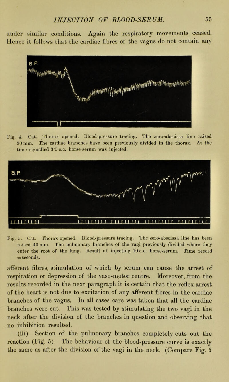 under similar conditions. Again the respiratory movements ceased. Hence it follows that the cardiac fibres of the vagus do not contain any Fig. 4. Cat. Thorax opened. Blood-pressure tracing. The zero-abscissa line raised 30 mm. The cardiac branches have been previously divided in the thorax. At the time signalled 3‘5 c.c. horse-serum was injected. Fig. 5. Cat. Thorax opened. Blood-pressure tracing. The zero-abscissa line has been raised 40 mm. The pulmonary branches of the vagi previously divided where they enter the root of the lung. Eesult of injecting 10 c.c. horse-serum. Time record = seconds. afferent fibres, stimulation of which by serum can cause the arrest of respiration or depression of the vaso-motor centre. Moreover, from the results recorded in the next paragraph it is certain that the reflex arrest of the heart is not due to excitation of any afferent fibres in the cardiac branches of the vagus. In all cases care was taken that all the cardiac branches were cut. This was tested by stimulating the two vagi in the neck after the division of the branches in question and observing that no inhibition resulted. (iii) Section of the pulmonary branches completely cuts out the reaction (Fig. 5). The behaviour of the blood-pressure curve is exactly the same as after the division of the vagi in the neck. (Compare Fig. 5