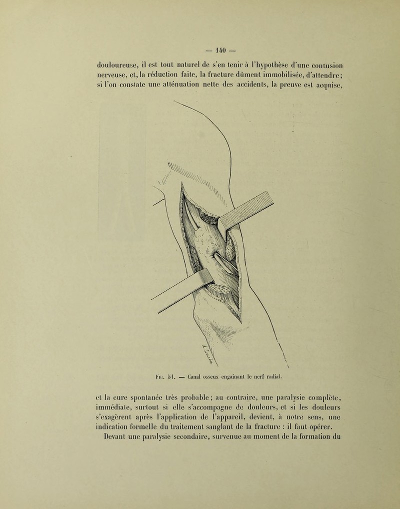 douloureuse, il est tout naturel de s’en tenir à l’hypothèse d’une contusion nerveuse, et, la réduction faite, la fracture dûment immobilisée, d’altendre; si l’on consiate une atténuation nette des accidents, la preuve est acquise, et la cure spontanée très probable; au contraire, nue paralysie complèle, immédiate, surtout si elle s’accompagne de douleurs, et si les douleiii's s’exagèrent après l’application de l’appareil, devient, à notre sens, une indication formelle du traitement sanglant de la fracture : il faut opérer. Devant une paralysie secondaire, survenue au moment de la formation du