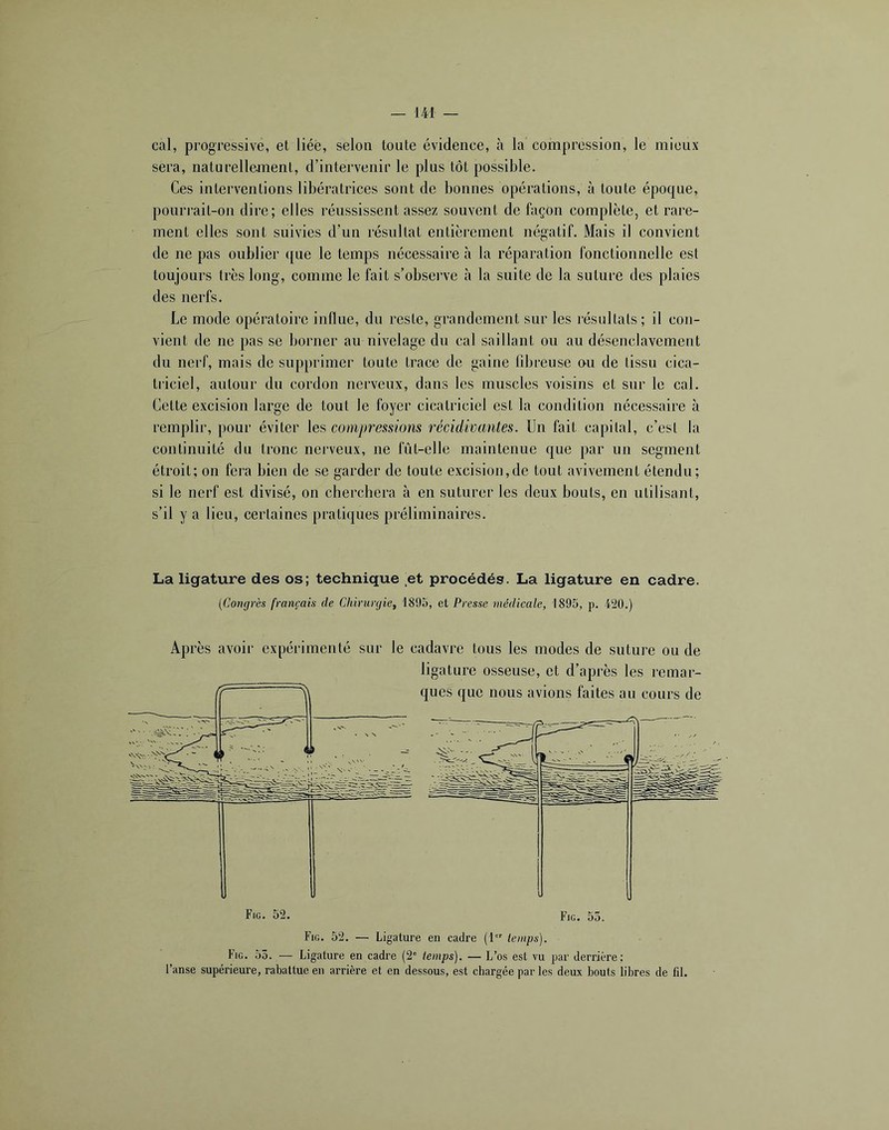 cal, progressive, et liée, selon toute évidence, à la compression, le mieux sera, naturellement, d’intervenir le plus tôt possible. Ces interventions libératrices sont de bonnes opérations, à tonte époque, pourrait-on dire; elles réussissent assez souvent de façon complète, et rare- ment elles sont suivies d’un résultat entièrement négatif. Mais il convient de ne pas oublier ({ue le temps nécessaire à la réparation fonctionnelle est toujours très long, comme le fait s’obsei’ve à la suite de la suture des plaies des nerfs. Le mode opératoire influe, du reste, grandement sur les résultats; il con- vient de ne pas se borner au nivelage du cal saillant ou au désenclavement du nerf, mais de supprimer toute trace de gaine fibreuse ou de tissu cica- triciel, autour du cordon nerveux, dans les muscles voisins et sur le cal. Cette excision large de tout le foyer cicatriciel est la condition nécessaire à remplir, pour éviter les compressions récidivantes. Un fait capital, c’est la continuité tlu tronc nerveux, ne lut-elle maintenue que par un segment étroit; on fera bien de se garder de toute excision,de tout avivement étendu; si le nerf est divisé, on cberchera à en suturer les deux bouts, en utilisant, s’il y a lieu, certaines pratiques préliminaires. La ligature des os; technique et procédés. La ligature en cadre. {Congrès français de Chirurgie, 1895, et Presse médicale, 1895, p. l^O.) Après avoir expérimenté sur le cadavre tous les modes de suture ou de ligature osseuse, et d’après les remar- ques que nous avions faites au cours de f 1 ( ' \ N Fig, 52. Fig. 55. Fig. 52. — Ligature en cadre (1 temps). Fig. 55. — Ligature en cadre (2' temps). — L’os est vu par derrière; l’anse supérieure, rabattue en arrière et en dessous, est chargée par les deux bouts libres de fil.