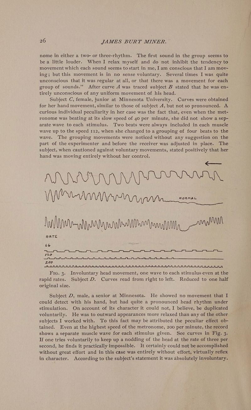 nome in either a two- or three-rhythm. The first sound in the group seems to be a little louder. WhenI relax myself and do not inhibit the tendency to movement which each sound seems to start in me, Iam conscious that I am moy- ing; but this movement is in no sense voluntary. Several times I was quite unconscious that it was regular at all, or that there was a movement for each group of sounds.” After curve A was traced subject B stated that he was en- tirely unconscious of any uniform movement of his head. Subject C, female, junior at Minnesota University. Curves were obtained for her hand movement, similar to those of subject A, but not so pronounced. A curious individual peculiarity in her case was the fact that, even when the met- ronome was beating at its slow speed of 40 per minute, she did not show a sep- arate wave to each stimulus. Two beats were always included in each muscle wave up to the speed 112, when she changed to a grouping of four beats to the wave. The grouping movements were noticed without any suggestion on the part of the experimenter and before the receiver was adjusted in place. The subject, when cautioned against voluntary movements, stated positively that her hand was moving entirely without her control. Fic. 3. Involuntary head movement, one wave to each stimulus even at the rapid rates. Subject D. Curves read from right to left. Reduced to one half original size. Subject D, male, a senior at Minnesota. He showed no movement that I could detect with his hand, but had quite a pronounced head rhythm under stimulation. On account of its character it could not, I believe, be duplicated voluntarily. He was to outward appearances more relaxed than any of the other subjects I worked with. To this fact may be attributed the peculiar effect ob- tained. Even at the highest speed of the metronome, 200 per minute, the record shows a separate muscle wave for each stimulus given. See curves in Fig. 3. If one tries voluntarily to keep up a nodding of the head at the rate of three per ~ second, he finds it practically impossible. It certainly could not be accomplished without great effort and in this case was entirely without effort, virtually reflex in character. According to the subject’s statement it was absolutely involuntary.