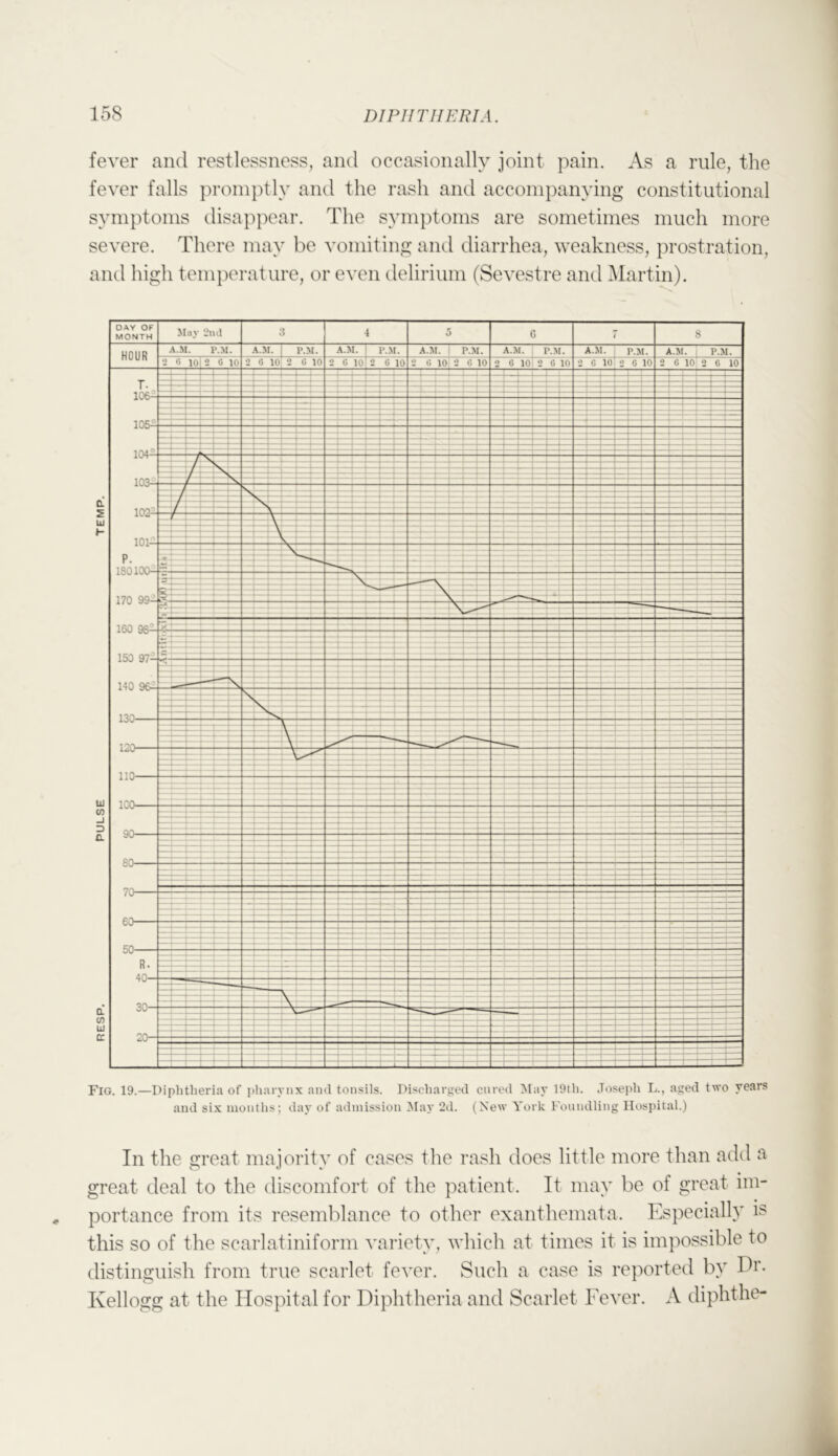 fever and restlessness, and occasionally joint pain. As a rule, the fever falls })roinptly anti the rash and accompanying constitutional symptoms disa}')}X'ar. The sym])toms are sometimes much more severe. There may be vomiting and diarrhea, weakness, prostration, and high tem|)erature, or even delirium (Sevestre and Martin). Fig. 19.—Diphtheria of pharynx and tonsils. Discharged cured May 19th. Joseph !>., aged two years and six months; day of admission iNIay 2d. (New York Foundling Hospital.) In the great majority of cases the rash does little more than add a great deal to the discomfort of the patient. It may be of great im- portance from its resemblance to other exanthemata. Especially is this so of the scarlatiniform variety, which at times it is imjiossible to distinguish from true scarlet fever. Such a case is reported by Ih’. Kellogg at the Hospital for Diphtheria and Scarlet Fever. A diphthe-