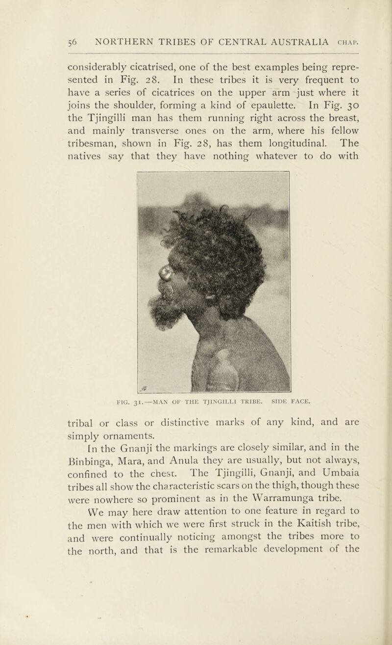 considerably cicatrised, one of the best examples being repre- sented in Fig. 28. In these tribes it is very frequent to have a series of cicatrices on the upper arm just where it joins the shoulder, forming a kind of epaulette. In Fig. 30 the Tjingilli man has them running right across the breast, and mainly transverse ones on the arm, where his fellow tribesman, shown in Fig. 28, has them longitudinal. The natives say that they have nothing whatever to do with FIG. 31.—MAN OF THE TJINGILLI TRIBE. SIDE FACE. tribal or class or distinctive marks of any kind, and are simply ornaments. In the Gnanji the markings are closely similar, and in the Binbinga, Mara, and Anula they are usually, but not always, confined to the chest. The Tjingilli, Gnanji, and Umbaia tribes all show the characteristic scars on the thigh, though these were nowhere so prominent as in the Warramunga tribe. We may here draw attention to one feature in regard to the men with which we were first struck in the Ivaitish tribe, and were continually noticing amongst the tribes more to the north, and that is the remarkable development of the