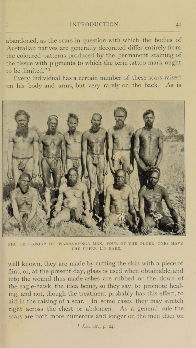 abandoned, as the scars in question with which the bodies of Australian natives are generally decorated differ entirely from the coloured patterns produced by the permanent staining of the tissue with pigments to which the term tattoo mark ought to be limited.”^ Every individual has a certain number of these scars raised on his body and arms, but very rarely on the back. As is FIG. 12.—GROUP OF WARRAMUNG.V MKN, FOUR OF TUK Ol.DKR ONKS HAVK TIIK UPI’KR I.IP RARE. well known, they are made by cutting the skin with a piece of flint, or, at the present day, glass is used when obtainable, and into the wound thus made ashes are rubbed or the down of the eagle-hawk, the idea being, so they say, to promote heal- ing, and not, though the treatment probably has this effect, to aid in the raising of a scar. In some cases the\' may stretch right across the chest or abdomen. As a general rule the scars are both more numerous and longer on the men than on ' Loc. cit., p. 24.