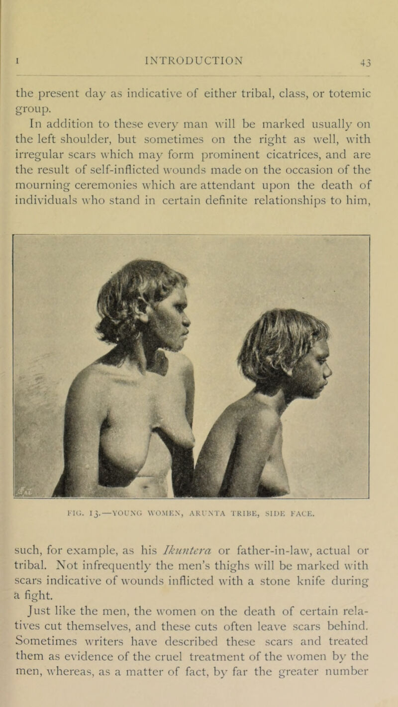 the present day as indicative of either tribal, class, or totemic group. In addition to these every man will be marked usually on the left shoulder, but sometimes on the right as well, with irregular scars which may form prominent cicatrices, and are the result of self-inflicted wounds made on the occasion of the mourning ceremonies which are attendant upon the death of individuals who stand in certain definite relationships to him, KU;. 13. — YOL'.\(; WO.MKN, ARI NTA TRIHE, SIDE RACE. such, for example, as his Ikuntcra or father-in-law, actual or tribal. Not infrequently the men’s thighs will be marked with scars indicative of wounds inflicted with a stone knife during a fight. Just like the men, the women on the death of certain rela- tives cut themselves, and these cuts often leave scars behind. Sometimes writers have described these scars and treated them as evidence of the cruel treatment of the women by the men, whereas, as a matter of fact, by far the greater number