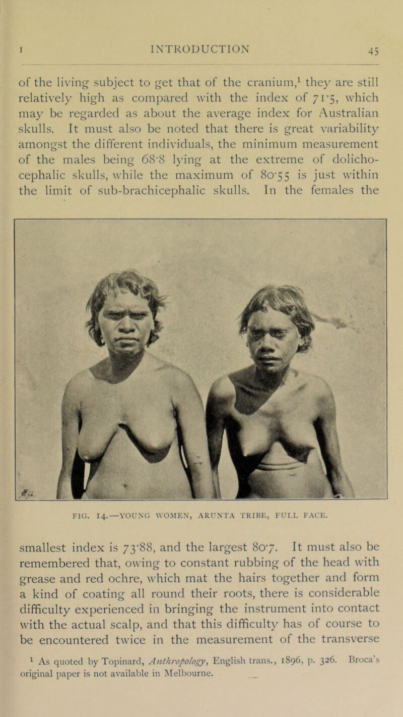 of the living subject to get that of the cranium,^ they are still relatively high as compared with the index of yi'S, which may be regarded as about the average index for Australian skulls. It must also be noted that there is great variability amongst the different individuals, the minimum measurement of the males being 68‘8 l}’ing at the extreme of dolicho- cephalic skulls, while the maximum of 8o'55 is just within the limit of sub-brachicephalic skulls. In the females the FK;. 14.—YOUNG WO.MKN, ARUNTA TRIBK, FUI.L FACK. smallest index is 73’88, and the largest 807. It must also be remembered that, owing to constant rubbing of the head with grease and red ochre, which mat the hairs together and form a kind of coating all round their roots, there is considerable difficulty experienced in bringing the instrument into contact with the actual scalp, and that this difficulty has of course to be encountered twice in the measurement of the transverse ^ As quoted by Topinard, Anthropology, English trans., 1896, p. 326. Broca’s original paper is not available in Melbourne. _