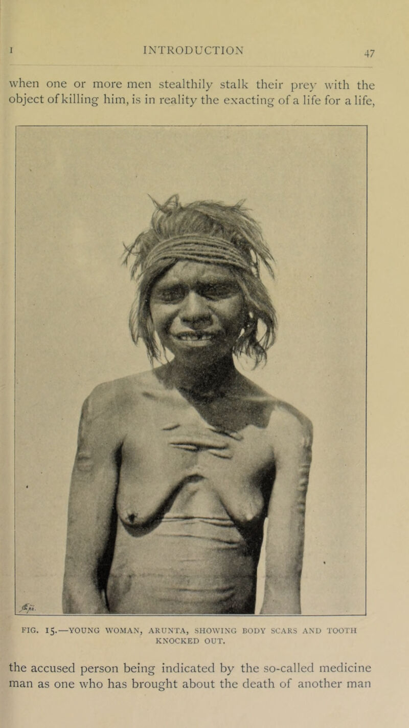 when one or more men stealthily stalk their pre\' with the object of killing him, is in reality the exacting of a life for a life, KIG. 15.—YOUNG WOMAN, ARUNTA, SHOWING BODY SCARS AND TOOTH KNOCKED OUT. the accused person being indicated by the so-called medicine man as one who has brought about the death of another man