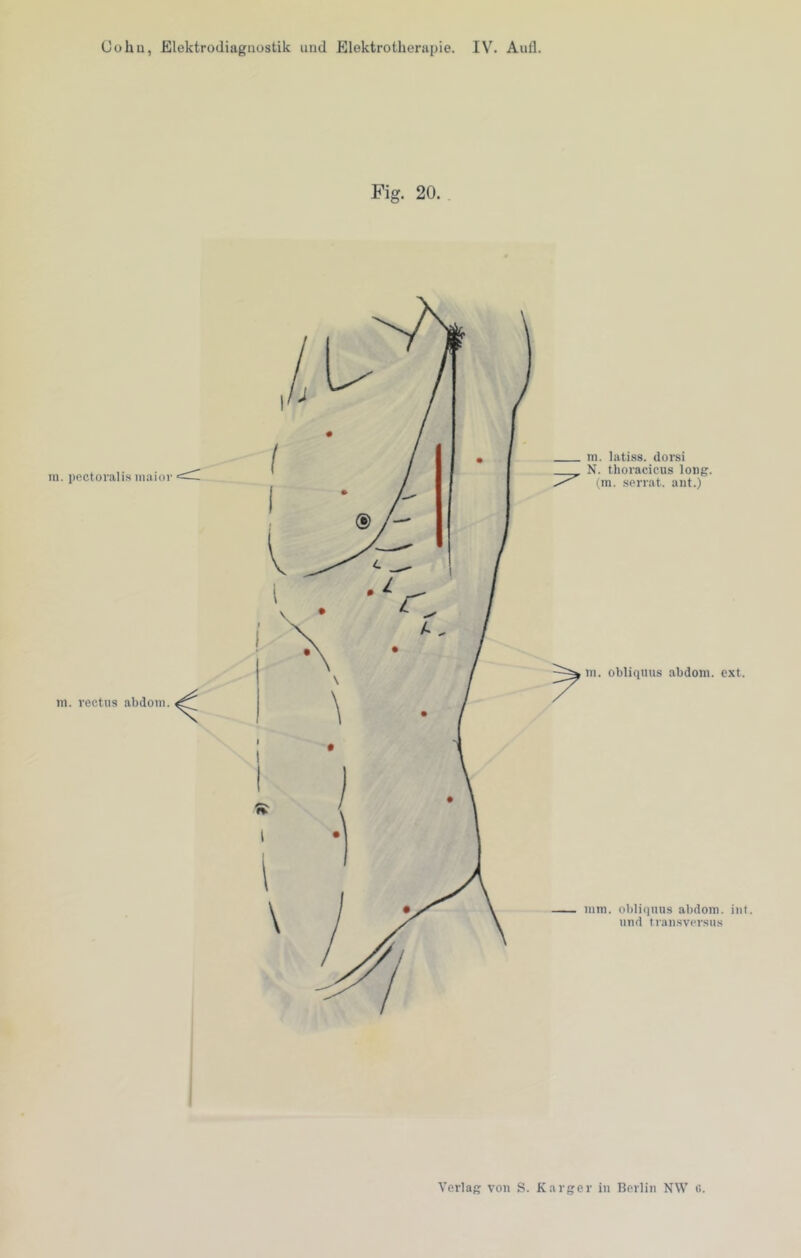 Fig. 20. Ul. pectoralis niaior m. rectus abdom. Ul. latiss. dorsi N. thoracicus loiig. (m. .serrat. aut.) Ul. obliquus abdom. ext. mm. obliquus abdom. iiit. und transversus