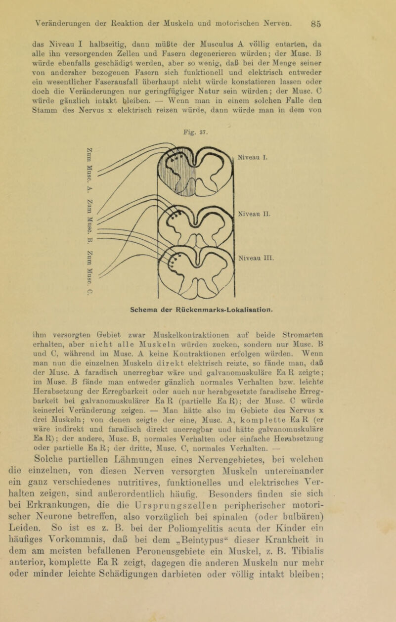 das Niveau I halbseitig, dann miiUte der Musculus A völlig entarten, da alle ihn versorgenden Zellen und Fasern degenerieren würden; der Muse. B würde ebenfalls geschädigt werden, aber so wenig, daß bei der Menge seiner von andersher bezogenen Fasern sich funktionell und elektrisch entweder ein wesentlicher Faserausfall überhaupt nicht würde konstatieren lassen oder doch die Veränderungen nur geringfügiger Natur sein würden; der Muse. 0 würde gänzlich intakt bleiben. — Wenn man in einem solchen P'alle den Stamm des Nervus x elektrisch reizen würde, dann würde man in dem von Fig. 27. 3 Niveau I. N i s oö p C N c 3 3 o p Niveau II. Niveau III. Schema der Rückenmarks-Lokalisation. ihn\ versorgten Gebiet zwar Muskelkontraktionen auf beide Stromarten erhalten, aber nicht alle Muskeln würden zuckeu, sondern nur Muse. B und C, während im Muse. A keine Kontraktionen erfolgen würden. Wenn man nun die einzelnen Muskeln direkt elektrisch reizte, so fände man, daß der Muse. A faradisch unerregbar wäre und galvanomuskuläre Ea R zeigte; im Muse. B fände man entweder gänzlich normales Verhalten bzw. leichte flerabsetzung der Erregbarkeit oder auch nur herabgesetzte faradische Erreg- barkeit bei galvanomuskulärer Ea R (partielle Ea R); der Muse. C würde keinerlei Veränderung zeigen. — Man hätte also im Gebiete des Nervus x drei Muskeln; von denen zeigte der eine, Muse. A, komplette Ea R (er wäre indirekt und faradisch direkt unerregbar und hätte galvanomuskuläre Ea R); der andere, Muse. B, normales Verhalten oder einfache Herabsetzung oder partielle EaR; der dritte, 3[usc. C, normales Verhalten. — Solche partiellen Lähmungen eines Nervengeliietes, bei welchen die einzelnen, von diesen Nerven versorgten Muskeln untereinander ein ganz verschiedenes nutritives, funktionelles und elektrisches Ver- halten zeigen, sind außerordentlich häufig. Besonders finden sie sich bei Erkrankungen, die die IJrsprungszellen [leripherischer motori- scher Neurone betreffen, also vorzüglich bei spinalen (oder bulbären) Leiden. So ist es z. B. bei der Poliomyelitis acuta der Kinder ein häufiges Vorkommnis, daß bei dem „Beintypus“ dieser Krankheit in dem am meisten befallenen Peroneusgehiete ein Muskel, z. B, Tibialis anterior, komplette EaR zeigt, dagegen die anderen Muskeln nur mehr oder minder leichte Schädigungen darbieten oder völlig intakt bleiben;