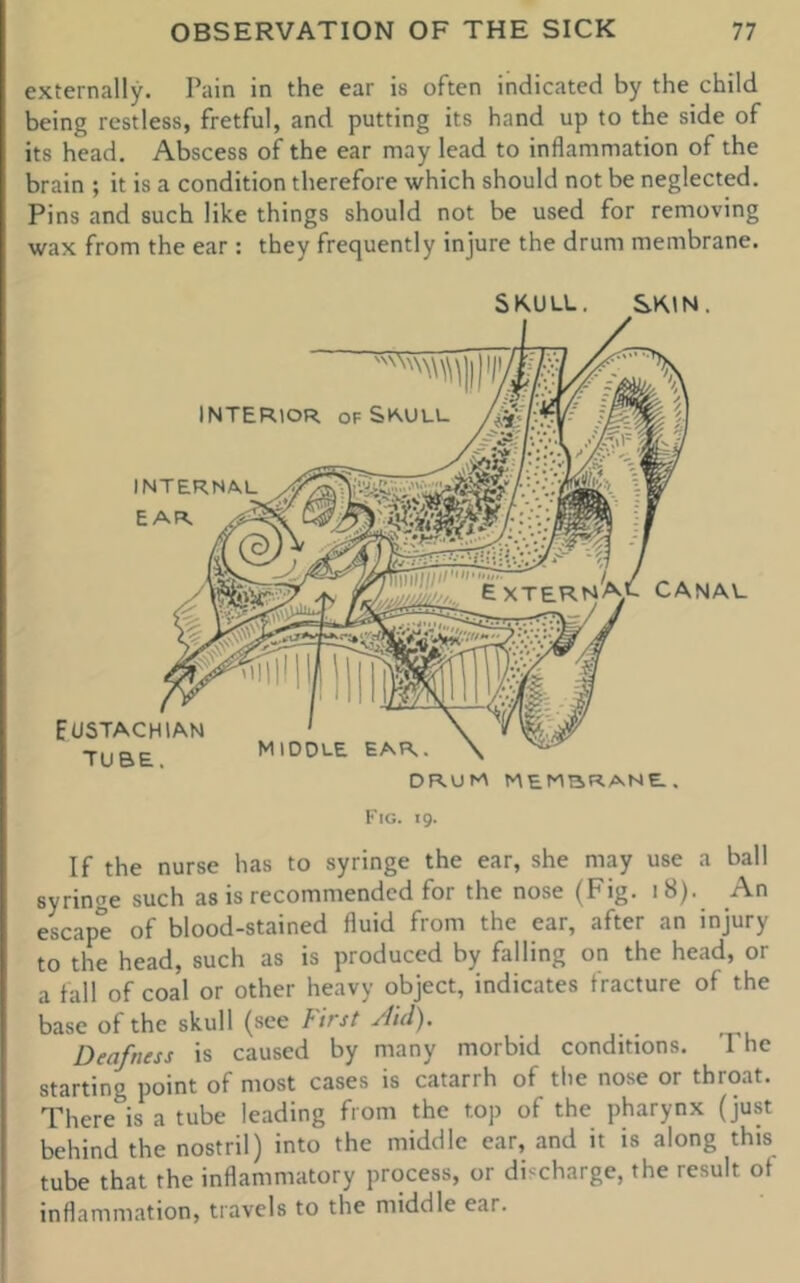 externally. Pain in the ear is often indicated by the child being restless, fretful, and putting its hand up to the side of its head. Abscess of the ear may lead to inflammation of the brain ; it is a condition therefore which should not be neglected. Pins and such like things should not be used for removing wax from the ear : they frequently injure the drum membrane. SKULL. SKIN. Fig. 19. If the nurse has to syringe the ear, she may use a ball syringe such as is recommended for the nose (Fig. 18). An escape of blood-stained fluid from the ear, after an injury to the head, such as is produced by falling on the head, or a fall of coal or other heavy object, indicates fracture of the base of the skull (see First Aid). Deafness is caused by many morbid conditions. The starting point of most cases is catarrh of the nose or throat. There is a tube leading from the top of the pharynx (just behind the nostril) into the middle ear, and it is along this tube that the inflammatory process, or discharge, the result of inflammation, travels to the middle ear.