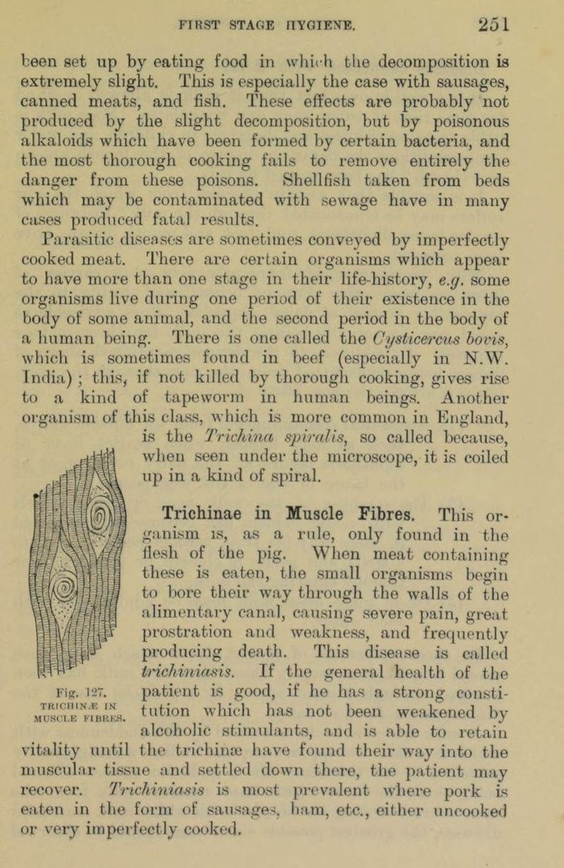 been set up by eating food in wliit-h the decomposition is extremely slight. This is especially the case with sausages, canned meats, and fish. These effects are probably not produced by the slight decomposition, but by poisonous alkaloids which have been formed by certain bacteria, and the most thorough cooking fails to remov'e entirely the danger from these poisons. Shellfish taken from beds which may be contaminated with sewage have in many cases produced fatal results. Parasitic diseases are sometimes conveyed by imperfectly cooked meat. There are certain organisms which appear to have more than one stage in their life-history, e.(j, some organisms live during one period of their existence in the body of some animal, and the second period in the body of a human being. There is one called the Cysiicerciis bovis, which is sometimes found in beef (especially in N.W. India) ; this, if not killed by thorough cooking, gives rise to a kind of tapeworm in human beings. Another organism of this class, which is more common in England, is the Trichina spiralis, so called liecause, when seen under the microscope, it is coiled up in a kind of spiral. Trichinae in Muscle Fibres. This or- ganism IS, as a rule, only found in the flesh of the pig. When meat containing these is eaten, the small organisms begin to bore their way through the walls of the alimentary canal, eau.sing severe pain, great prostration and weakne.ss, and freriuently producing death. This disease is called tnchiniasis. If the general health of the patient is good, if he has a strong consti- tution which has not been weakened by alcoholic stimulants, and is able to retain the trichinaj have found their way into the muscular tissue and settled down thei-e, the patient may recover. Trichiniasis is most prevalent where pork is eaten in the form of sausages, ham, etc., either uneooke<J or %'ery imperfectly cooked. MUHCLE vitality until