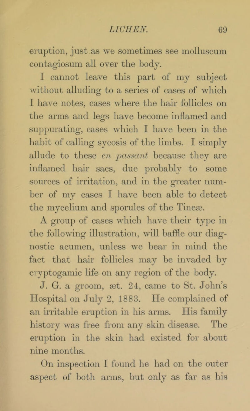 enn)tion, just as we sometimes see molluscum contagiosum all over the body. I cannot leave this part of my subject without alluding to a series of cases of which I have notes, cases where the hair follicles on the arms and legs have become inflamed and suppurating, cases which I have been in the habit of calling sycosis of the limbs. I simply allude to these en passant because they are inflamed hair sacs, due probaldy to some sources of irritation, and in the greater num- ber of my cases I have been able to detect the mycelium and sporules of the Tineae. A group of cases which have their type in the following illustration, will hafHe our diag- nostic acumen, unless we bear in mind the fact that hair follicles may be invaded by cryptogainic life on any region of the body. J. G. a groom, tet. 24, came to St. Johns Hospital on July 2, 1883. He complained of an irritable eruption in his arms. His family history was free from any skin disease. The eruption in the skin had existed for about nine months. On inspection I found he had on the outer aspect of both arms, but only as far as his