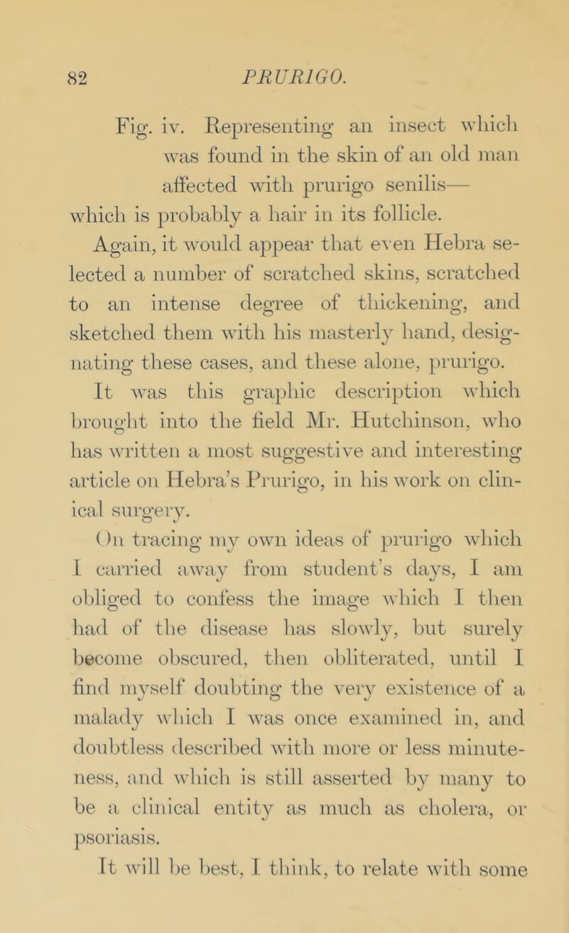 Fig’, iv. Representing’ an insect which was found in the skin of an old man affected witli prurigo senilis— which is prohalily a hair in its follicle. Again, it would appear that e^'en Hebra se- lected a nimiher of scratched skins, scratched to an intense degree of thickening, and sketched them with his masterly hand, desig- nating these cases, and these alojie, prurigo. It was this g’ra})hic description which hrouo-ht into the field Mr. Hutchinson, who has written a most suggestive and interesting article on Hebra’s Prurigo, in his work on clin- ical sui’o’ery. On tracing my own ideas of prurigo which L carried away from student’s days, I am obliged to confess the image which I then liad of tlie disease has slowly, but surely become obscured, then obliterated, until I find mvself doubtinn’ the verv existence of a malady wliich I was once examined in, and doubtless described with more or less minute- ness, and which is still asserted by many to be a clinical entity as much as cholera, or psoriasis. It will 1 )e best, I think, to relate with some
