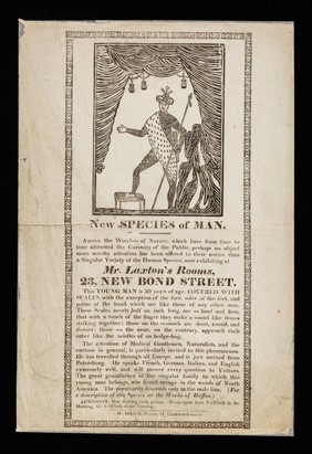 New species of man ... : now exhibiting at Mr. Laxton's Rooms, 23, New Bond Street. This young man is 30 years of age, covered with scales ...