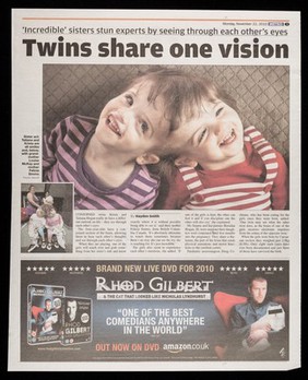 Twins share one vision : 'incredible' sisters stun experts by seeing through each other's eyes.