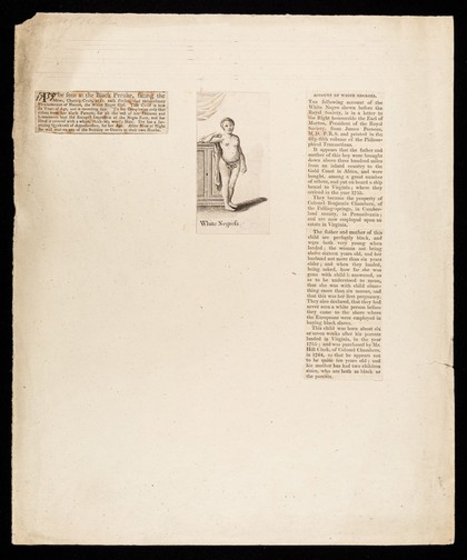 To be seen at the Black Peruke, facing the mews, Charing-Cross ... : White negress : account of white negroes.