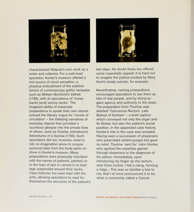 characterised Walpole’s own work as a writer and collector. For a well-read spectator, Hunter’s museum offered a rich source of novel sensation, a physical embodiment of the sublime terrors of contemporary gothic fantasies such as William Beckford’s Vathek (1786), with its abundance of ‘hump- backs [and] wenny necks’. The imagined ability of inanimate preparations to speak their own stories echoed the literary vogue for ‘novels of circulation’ - the titillating narratives of everyday objects that provided a scurrilous glimpse into the private lives of others, such as Charles Johnstone’s Adventures of a Guinea (1760). Such spectators did not, however, need to rely on imagination alone to conjure personal tales from the body parts on show in Hunter’s museum. Many preparations were physically inscribed with the names of patients, painted on to the tops of jars or carved in to lead tags suspended around their necks. Case-histories too were kept with the pots, allowing spectators to read for themselves the accounts of the patient’s Narrative Remains I 12 last days. No doubt these too offered some voyeuristic appeal: it is hard not to imagine the pathos evoked by Mary Hunt’s lonely suicide, for example. Nevertheless, naming preparations encouraged spectators to see them as bits of real people, and by doing so gave agency and authority to the dead. The preparation from Thurlow was labelled ‘Cancerous Rectum. Late Bishop of Durham’ - a brief caption which conveyed not only the organ and its illness, but also the patient’s social position. In the appended case history, Hunter’s role in the case was revealed. Having seen a succession of physicians who prescribed violent purges but gave no relief, Thurlow ‘sent for’ John Hunter, who applied the expertise gained through dissection to the diagnosis of his patron: Immediately, upon introducing my finger up the rectum, near three inches, I felt a rising, forming a ridge...This was so familiar a feel to me, that I at once pronounced it to be what is commonly called a Cancer.
