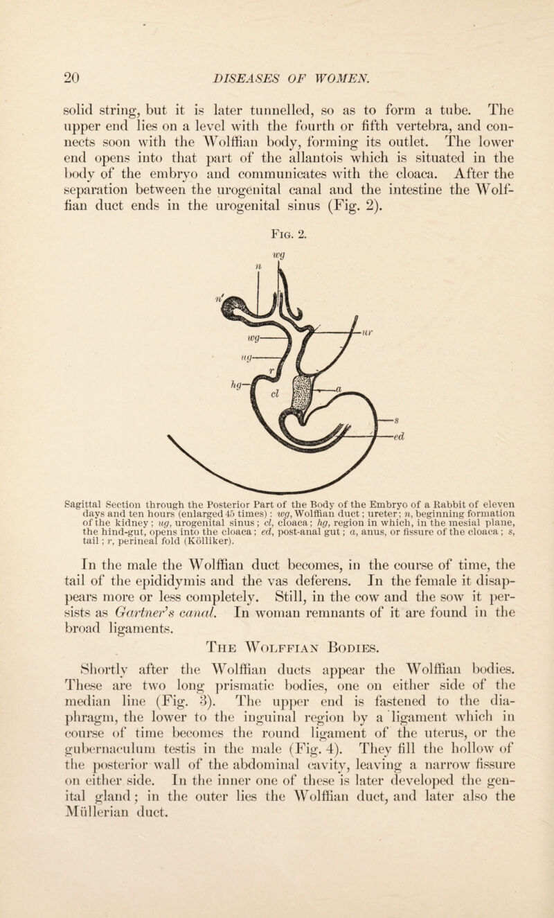 solid string, but it is later tunnelled, so as to form a tube. The upper end lies on a level with the fourth or fifth vertebra, and con¬ nects soon with the Wolffian body, forming its outlet. The lower end opens into that part of the allantois which is situated in the body of the embryo and communicates with the cloaca. After the separation between the urogenital canal and the intestine the Wolf¬ fian duct ends in the urogenital sinus (Fig. 2). Fig. 2. iog Sagittal Section through the Posterior Part of the Body of the Embryo of a Rabbit of eleven days and ten hours (enlarged45 times): wg, Wolffian duct; ureter; n, beginning formation of the kidney ; ug, urogenital sinus ; cl, cloaca; hg, region in which, in the mesial plane, the hind-gut, opens into the cloaca; ed, post-anal gut; a, anus, or fissure of the cloaca ; s, tail; r, perineal fold (Kolliker). In the male the Wolffian duct becomes, in the course of time, the tail of the epididymis and the vas deferens. In the female it disap¬ pears more or less completely. Still, in the cow and the sow it per¬ sists as Gartner’s canal. In woman remnants of it are found in the broad ligaments. The Wolffian Bodies. Shortly after the Wolffian ducts appear the Wolffian bodies. These are two long prismatic bodies, one on either side of the median line (Fig. 3). The upper end is fastened to the dia¬ phragm, the lower to the inguinal region by a ligament which in course of time becomes the round ligament of the uterus, or the gubernaculum testis in the male (Fig. 4). They fill the hollow of the posterior wall of the abdominal cavity, leaving a narrow fissure on either side. In the inner one of these is later developed the gen¬ ital gland; in the outer lies the Wolffian duct, and later also the Mullerian duct.