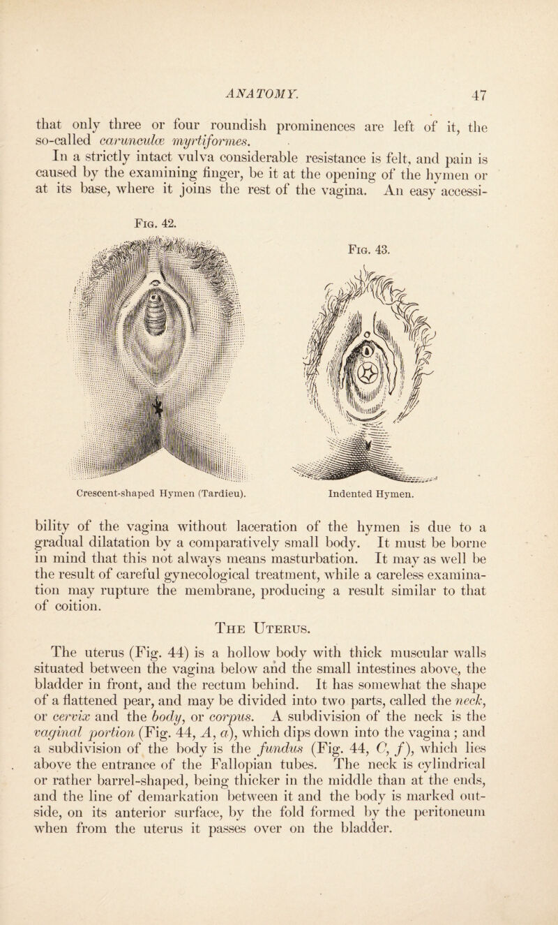 that only three or four roundish prominences are left of it, the so-called carunculce myrtiformes. In a strictly intact vulva considerable resistance is felt, and pain is caused by the examining finger, be it at the opening of the hymen or at its base, where it joins the rest ol the vagina. An easy accessi- Fig. 42. Crescent-shaped Hymen (Tardieu). Indented Hymen. bility of the vagina without laceration of the hymen is due to a gradual dilatation by a comparatively small body. It must be borne in mind that this not always means masturbation. It may as well be the result of careful gynecological treatment, while a careless examina¬ tion may rupture the membrane, producing a result similar to that of coition. The Uterus. The uterus (Fig. 44) is a hollow body with thick muscular walls situated between the vagina below and the small intestines above, the bladder in front, and the rectum behind. It has somewhat the shape of a flattened pear, and may be divided into two parts, called the neck, or cervix and the body, or corpus. A subdivision of the neck is the vaginal portion (Fig. 44, A, a), which dips down into the vagina; and a subdivision of the body is the fundus (Fig. 44, (?, /), which lies above the entrance of the Fallopian tubes. The neck is cylindrical or rather barrel-shaped, being thicker in the middle than at the ends, and the line of demarkation between it and the body is marked out¬ side, on its anterior surface, by the fold formed by the peritoneum when from the uterus it passes over on the bladder.