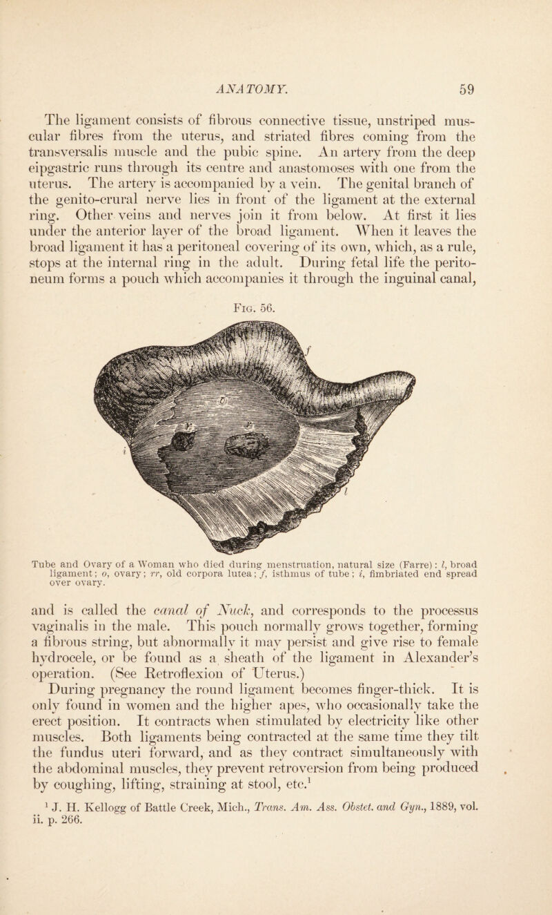 The ligament consists of fibrous connective tissue, unstriped mus¬ cular fibres from the uterus, and striated fibres coming from the transversalis muscle and the pubic spine. An artery from the deep eipgastric runs through its centre and anastomoses with one from the uterus. The artery is accompanied by a vein. The genital branch of the genito-crural nerve lies in front of the ligament at the external ring. Other veins and nerves join it from below. At first it lies under the anterior layer of the broad ligament. When it leaves the broad ligament it has a peritoneal covering of its own, which, as a rule, stops at the internal ring in the adult. During fetal life the perito¬ neum forms a pouch which accompanies it through the inguinal canal, Fig. 56. Tube and Ovary of a Woman who died during menstruation, natural size (Farre): l, broad ligament; o, ovary; rr, old corpora lutea; /, isthmus of tube; i, fimbriated end spread over ovary. and is called the canal of Nuclc, and corresponds to the processus vaginalis in the male. This pouch normally grows together, forming a fibrous string, but abnormally it may persist and give rise to female hydrocele, or be found as a sheath of the ligament in Alexander’s operation. (See Retroflexion of Uterus.) During pregnancy the round ligament becomes finger-thick. It is only found in women and the higher apes, who occasionally take the erect position. It contracts when stimulated by electricity like other muscles. Both ligaments being contracted at the same time they tilt the fundus uteri forward, and as they contract simultaneously with the abdominal muscles, they prevent retroversion from being produced by coughing, lifting, straining at stool, etc.1 1 J. H. Kellogg of Battle Creek, Mich., Trans. Am. ^4ss. Obstet. and Gyn., 1889, vol. ii. p. 266.