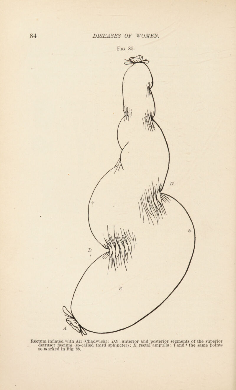 Fig. 85. Rectum inflated with Air (Chadwick): BD\ anterior and posterior segments of the superior detrusor fsecium (so-called third sphincter); E, rectal ampulla; f and * the same points so marked in Fig. 88.