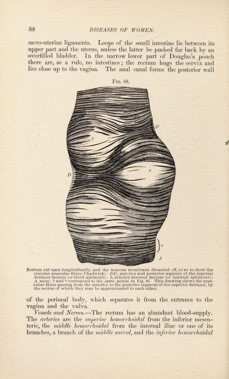 sacrouterine ligaments. Loops of the small intestine lie between its upper part and the uterus, unless the latter be pushed far back by an overfilled bladder. In the narrow lower part of Douglas’s pouch there are, as a rule, no intestines; the rectum hugs the cervix and lies close up to the vagina. The anal canal forms the posterior wall Fig. 88. Rectum cut open longitudinally, and the mucous membrane dissected off, so as to show the circular muscular fibres (Chadwick): Dl)', anterior and posterior segment of the superior detrusor fsecium (or third sphincter); S, inferior detrusor fsecium (or internal sphincter); A, anus ; f and * correspond to the same points in Fig. 85. This drawing shows the mus¬ cular fibres passing from the anterior to the posterior segment of the superior detrusor, by ■the action of which they may be approximated to each other. of the perineal body, which separates it from the entrance to the vagina and the vulva. Vessels and Nerves.—The rectum has an abundant blood-supply. The arteries are the superior hemorrhoidal from the inferior mesen¬ teric, the middle hemorrhoidal from the internal iliac or one of its branches, a branch of the middle sacral, and the inferior hemorrhoidal