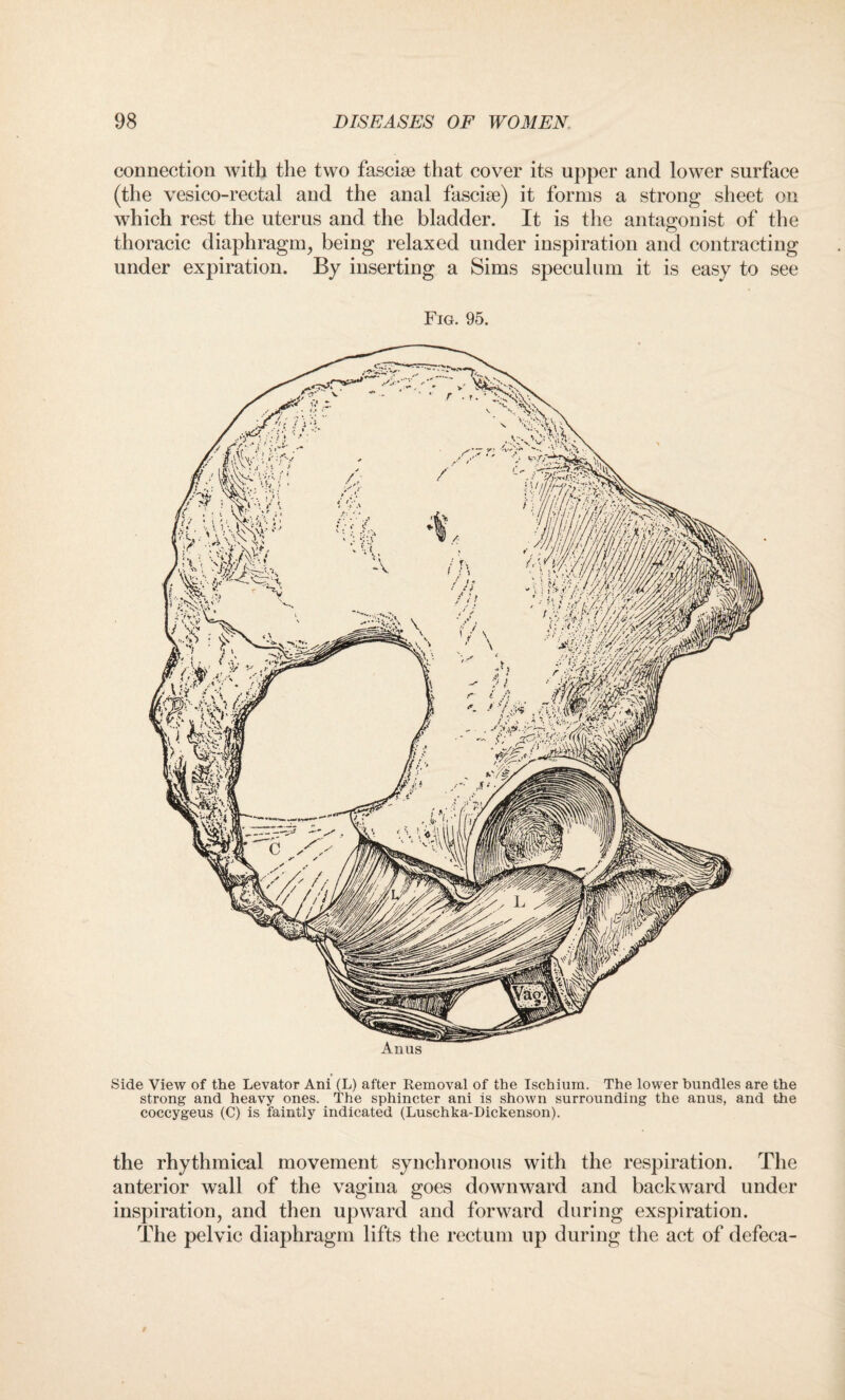 connection with the two fasciae that cover its upper and lower surface (the vesico-rectal and the anal fasciae) it forms a strong sheet on which rest the uterus and the bladder. It is the antagonist of the thoracic diaphragm, being relaxed under inspiration and contracting under expiration. By inserting a Sims speculum it is easy to see Fig. 95. Side View of the Levator Ani (L) after Removal of the Ischium. The lower bundles are the strong and heavy ones. The sphincter ani is shown surrounding the anus, and the coccygeus (C) is faintly indicated (Luschka-Dickenson). the rhythmical movement synchronous with the respiration. The anterior wall of the vagina goes downward and backward under inspiration, and then upward and forward during exspiration. The pelvic diaphragm lifts the rectum up during the act of defeca-