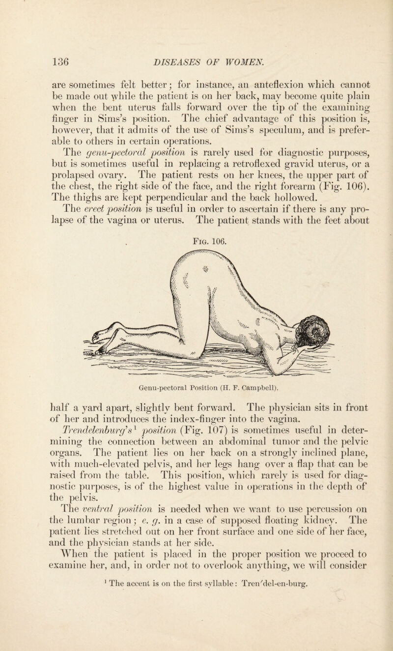 are sometimes felt better; for instance, an anteflexion which cannot be made out \vhile the patient is on her back, may become quite plain when the bent uterus falls forward over the tip of the examining finger in Sims’s position. The chief advantage of this position is, however, that it admits of the use of Sims’s speculum, and is prefer¬ able to others in certain operations. The genu-pectoral position is rarely used for diagnostic purposes, but is sometimes useful in replacing a retroflexed gravid uterus, or a prolapsed ovary. The patient rests on her knees, the upper part of the chest, the right side of the face, and the right forearm (Fig. 106). The thighs are kept perpendicular and the back hollowed. The erect position is useful in order to ascertain if there is any pro¬ lapse of the vagina or uterus. The patient stands with the feet about Fig. 106. Genu-pectoral Position (H. F. Campbell). half a yard apart, slightly bent forward. The physician sits in front of her and introduces the index-finger into the vagina. Trendelenburg’s1 position (Fig. 107) is sometimes useful in deter¬ mining the connection between an abdominal tumor and the pelvic organs. The patient lies on her back on a strongly inclined plane, with much-elevated pelvis, and her legs hang over a flap that can be raised from the table. This position, which rarely is used for diag¬ nostic purposes, is of the highest value in operations in the depth of the pelvis. The ventral position is needed when we want to use percussion on the lumbar region; e. g. in a case of supposed floating kidney. The patient lies stretched out on her front surface and one side of her face, and the physician stands at her side. When the patient is placed in the proper position we proceed to examine her, and, in order not to overlook anything, we will consider 1 The accent is on the first syllable: Trenhlel-en-burg.