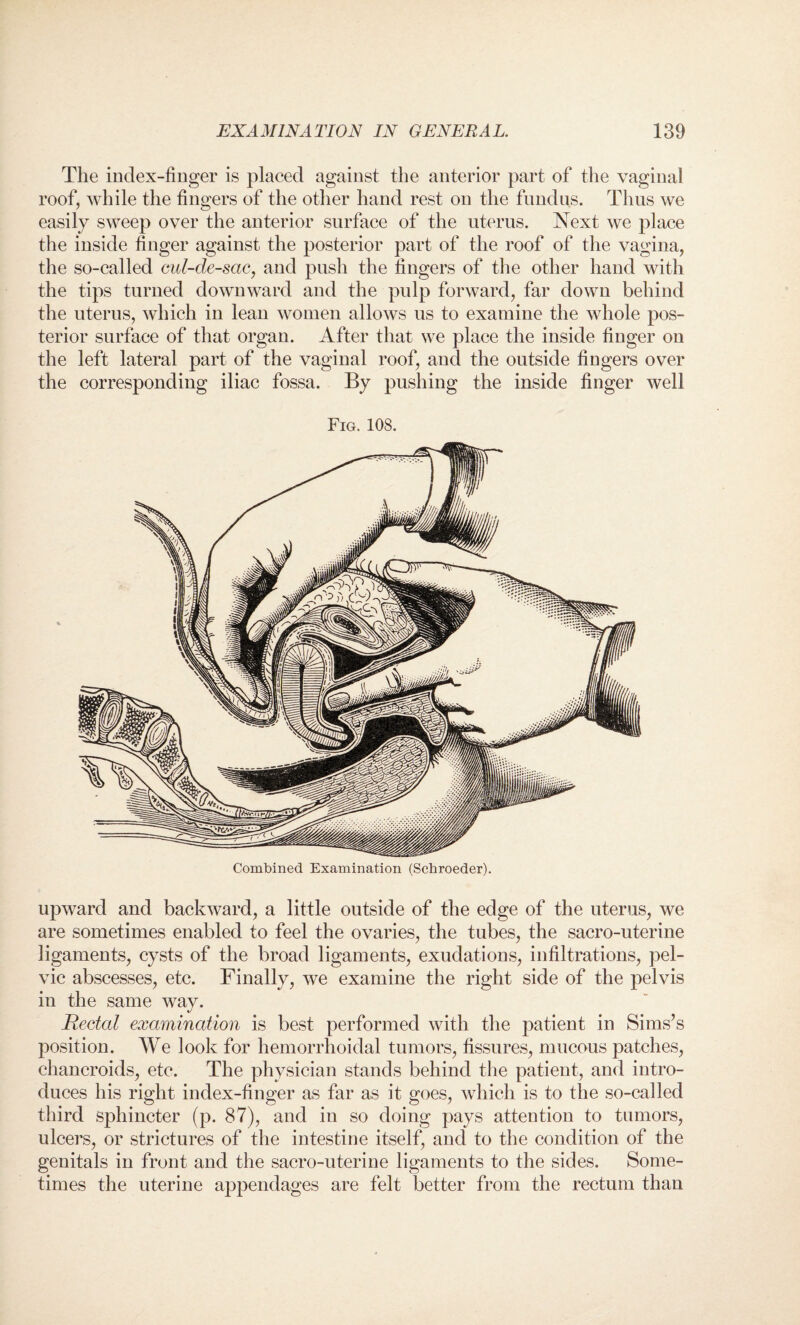 The index-finger is placed against the anterior part of the vaginal roof, while the fingers of the other hand rest on the fundus. Thus we easily sweep over the anterior surface of the uterus. Next we place the inside finger against the posterior part of the roof of the vagina, the so-called cul-de-sac, and push the fingers of the other hand with the tips turned downward and the pulp forward, far down behind the uterus, which in lean women allows us to examine the whole pos¬ terior surface of that organ. After that we place the inside finger on the left lateral part of the vaginal roof, and the outside fingers over the corresponding iliac fossa. By pushing the inside finger well Fig. 108. upward and backward, a little outside of the edge of the uterus, we are sometimes enabled to feel the ovaries, the tubes, the sacro-uterine ligaments, cysts of the broad ligaments, exudations, infiltrations, pel¬ vic abscesses, etc. Finally, we examine the right side of the pelvis in the same way. Rectal examination is best performed with the patient in Sims’s position. We look for hemorrhoidal tumors, fissures, mucous patches, chancroids, etc. The physician stands behind the patient, and intro¬ duces his right index-finger as far as it goes, which is to the so-called third sphincter (p. 87), and in so doing pays attention to tumors, ulcers, or strictures of the intestine itself, and to the condition of the genitals in front and the sacro-uterine ligaments to the sides. Some¬ times the uterine appendages are felt better from the rectum than