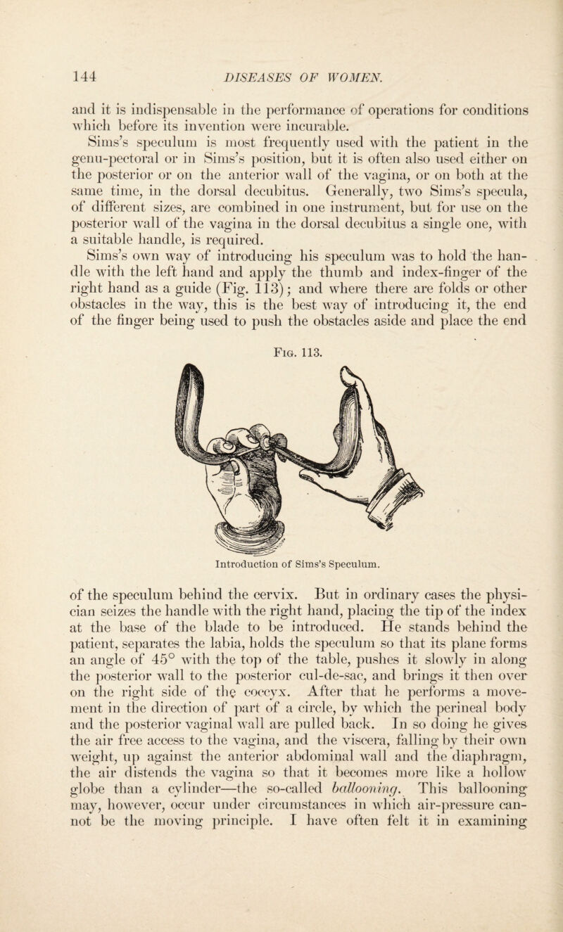 and it is indispensable in the performance of operations for conditions which before its invention were incurable. Sims’s speculum is most frequently used with the patient in the genu-pectoral or in Sims’s position, but it is often also used either on the posterior or on the anterior wall of the vagina, or on both at the same time, in the dorsal decubitus. Generally, two Sims’s specula, of different sizes, are combined in one instrument, but for use on the posterior wall of the vagina in the dorsal decubitus a single one, with a suitable handle, is required. Sims’s own way of introducing his speculum was to hold the han¬ dle with the left hand and apply the thumb and index-finger of the right hand as a guide (Fig. 113); and where there are folds or other obstacles in the way, this is the best way of introducing it, the end of the finger being used to push the obstacles aside and place the end Fig. 113. Introduction of Sims’s Speculum. of the speculum behind the cervix. But in ordinary cases the physi¬ cian seizes the handle with the right hand, placing the tip of the index at the base of the blade to be introduced. He stands behind the patient, separates the labia, holds the speculum so that its plane forms an angle of 45° with the top of the table, pushes it slowly in along the posterior wall to the posterior cul-de-sac, and brings it then over on the right side of the coccyx. After that he performs a move¬ ment in the direction of part of a circle, by which the perineal body and the posterior vaginal wall are pulled back. In so doing he gives the air free access to the vagina, and the viscera, falling by their own weight, up against the anterior abdominal wall and the diaphragm, the air distends the vagina so that it becomes more like a hollow globe than a cylinder—the so-called ballooning. This ballooning may, however, occur under circumstances in which air-pressure can¬ not be the moving principle. I have often felt it in examining