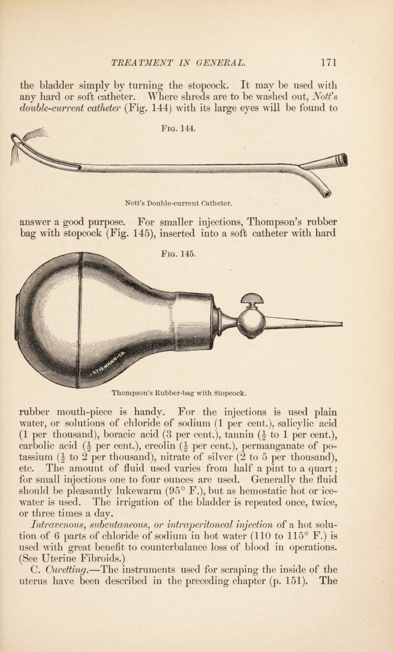 the bladder simply by turning the stopcock. It may be used with any hard or soft catheter. Where shreds are to be washed out, Nott’s double-current catheter (Fig. 144) with its large eyes will be found to answer a good purpose. For smaller injections, Thompson’s rubber bag with stopcock (Fig. 145), inserted into a soft catheter with hard Thompson’s Rubber-bag with Stopcock. rubber mouth-piece is handy. For the injections is used plain water, or solutions of chloride of sodium (1 per cent.), salicylic acid (1 per thousand), boracic acid (3 per cent.), tannin (J to 1 per cent.), carbolic acid (J per cent.), creolin (J per cent.), permanganate of po¬ tassium (^ to 2 per thousand), nitrate of silver (2 to 5 per thousand), etc. The amount of fluid used varies from half a pint to a quart; for small injections one to four ounces are used. Generally the fluid should be pleasantly lukewarm (95° F.), but as hemostatic hot or ice- water is used. The irrigation of the bladder is repeated once, twice, or three times a day. Intravenous, subcutaneous, or intraperitoneal injection of a hot solu¬ tion of 6 parts of chloride of sodium in hot water (110 to 115° F.) is used with great benefit to counterbalance loss of blood in operations. (See Uterine Fibroids.) C. Curetting.—The instruments used for scraping the inside of the uterus have been described in the preceding chapter (p. 151). The