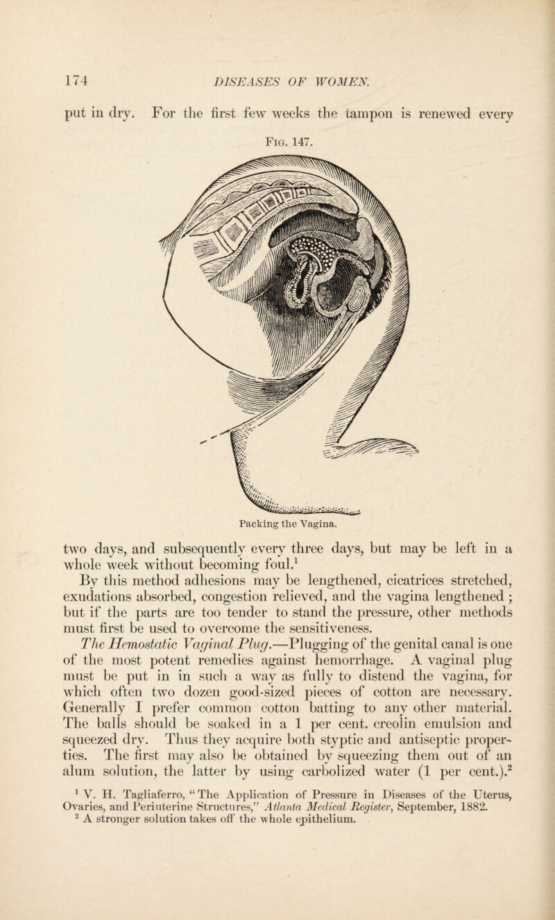 put in dry. For the first few weeks the tampon is renewed every Fig. 147. Packing the Vagina. two days, and subsequently every three days, but may be left in a whole week without becoming foul.1 By this method adhesions may be lengthened, cicatrices stretched, exudations absorbed, congestion relieved, and the vagina lengthened ; but if the parts are too tender to stand the pressure, other methods must first be used to overcome the sensitiveness. The Hemostatic Vaginal Plug.—Plugging of the genital canal is one of the most potent remedies against hemorrhage. A vaginal plug must be put in in such a way as fully to distend the vagina, for which often two dozen good-sized pieces of cotton are necessary. Generally I prefer common cotton batting to any other material. The balls should be soaked in a 1 per cent, creolin emulsion and squeezed dry. Thus they acquire both styptic and antiseptic proper* ties. The first may also be obtained by squeezing them out of an alum solution, the latter by using carbolized water (1 per cent.).2 1 V. H. Tagliaferro, “ The Application of Pressure in Diseases of the Uterus, Ovaries, and Periuterine Structures,” Atlanta Medical Register, September, 1882. 2 A stronger solution takes off the whole epithelium.
