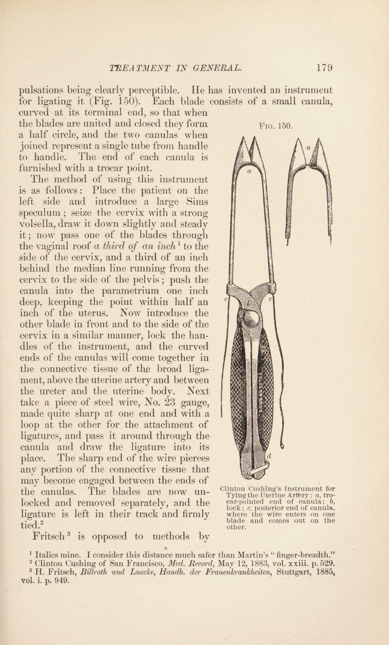 Fig. 150. pulsations being clearly perceptible. He lias invented an instrument for ligating it (Fig. 150). Each blade consists of a small canula, curved at its terminal end, so that when the blades are united and closed they form a half circle, and the two canulas when joined represent a single tube from handle to handle. The end of each canula is furnished with a trocar point. The method of using this instrument is as follows: Place the patient on the left side and introduce a large Sims speculum ; seize the cervix with a strong volsella, draw it down slightly and steady it; now pass one of the blades through the vaginal roof a third of an inch1 to the side of the cervix, and a third of an inch behind the median line running from the cervix to the side of the pelvis; push the canula into the parametrium one inch deep, keeping the point within half an inch of the uterus. Now introduce the other blade in front and to the side of the cervix in a similar manner, lock the han¬ dles of the instrument, and the curved ends of the canulas will come together in the connective tissue of tire broad liga¬ ment, above the uterine artery and between the ureter and the uterine body. Next take a piece of steel wire, No. 23 gauge, made quite sharp at one end and with a loop at the other for the attachment of ligatures, and pass it around through the canula and draw the ligature into its place. The sharp end of the wire pierces any portion of the connective tissue that may become engaged between the ends of the canulas. The blades are now un¬ locked and removed separately, and the ligature is left in their track and firmly tied.2 Fritsch3 is opposed to methods by Clinton Cushing’s Instrument for Tying the Uterine Artery: a, tro¬ car-pointed end of canula; b, lock; c, posterior end of canula, where the wire enters on one blade and comes out on the other. 1 Italics mine. I consider this distance much safer than Martin’s “ finger-breadth.” 2 Clinton Cushing of San Francisco, Med. Record, May 12, 1883, vol. xxiii. p. 529. 3 H. Fritsch, Billroth und Luecke, Handb. der Frauenkrankheiten, Stuttgart, 1885, vol. i. p. 949.