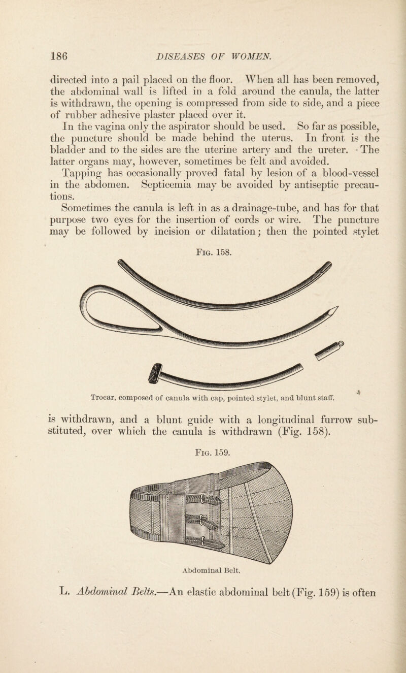 directed into a pail placed on the floor. When all has been removed, the abdominal wall is lifted in a fold around the canula, the latter is withdrawn, the opening is compressed from side to side, and a piece of rubber adhesive plaster placed over it. In the vagina only the aspirator should be used. So far as possible, the puncture should be made behind the uterus. In front is the bladder and to the sides are the uterine artery and the ureter. The latter organs may, however, sometimes be felt and avoided. Tapping has occasionally proved fatal by lesion of a blood-vessel in the abdomen. Septicemia may be avoided by antiseptic precau¬ tions. Sometimes the canula is left in as a drainage-tube, and has for that purpose two eyes for the insertion of cords or wire. The puncture may be followed by incision or dilatation; then the pointed stylet Fig. 158. Trocar, composed of canula with cap, pointed stylet, and blunt staff. is withdrawn, and a blunt guide with a longitudinal furrow sub¬ stituted, over which the canula is withdrawn (Fig. 158). Fig. 159. Abdominal Belt. L. Abdominal Belts.—An elastic abdominal belt (Fig. 159) is often