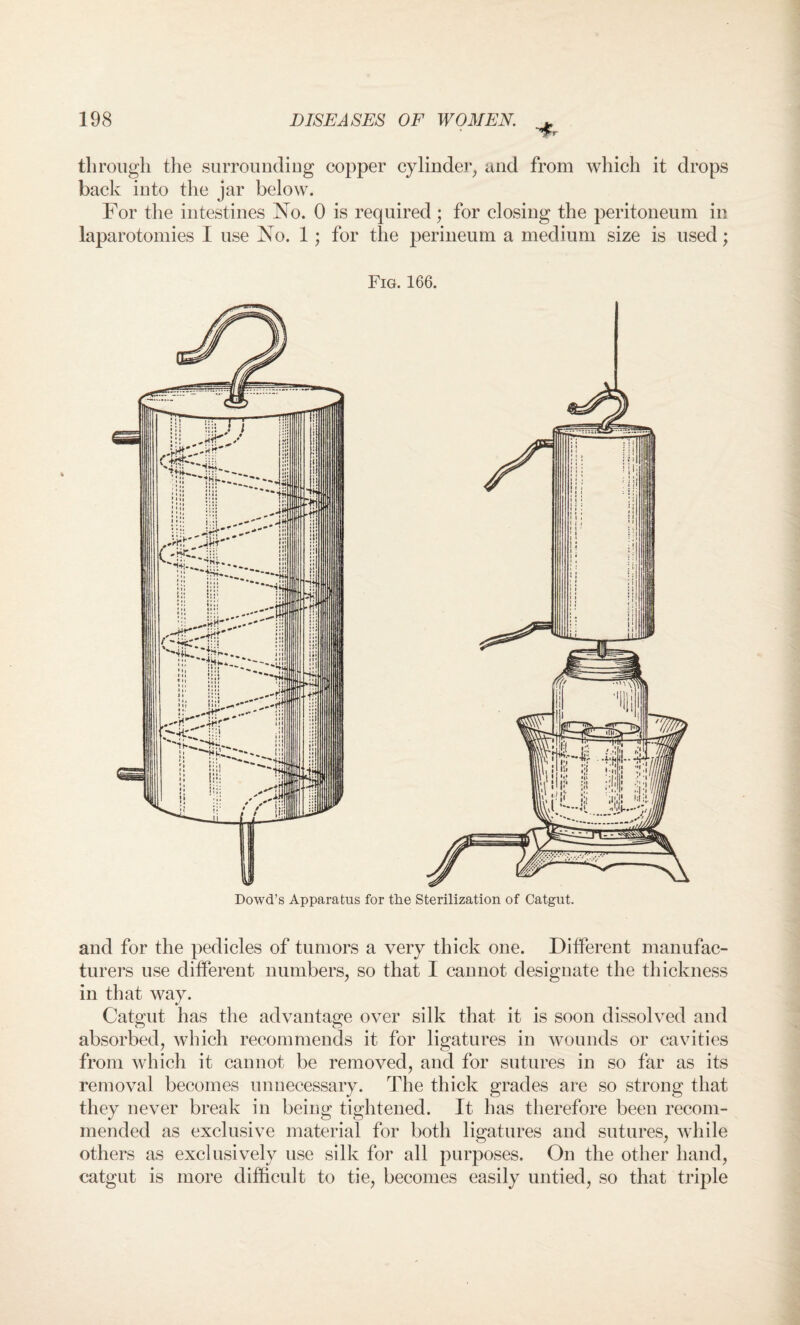 through tlie surrounding copper cylinder, and from which it drops back into the jar below. For the intestines No. 0 is required; for closing the peritoneum in laparotomies I use No. 1; for the perineum a medium size is used; Fig. 166. Dowd’s Apparatus for the Sterilization of Catgut. and for the pedicles of tumors a very thick one. Different manufac¬ turers use different numbers, so that I cannot designate the thickness in that way. Catgut has the advantage over silk that it is soon dissolved and absorbed, which recommends it for ligatures in wounds or cavities from which it cannot be removed, and for sutures in so far as its removal becomes unnecessary. The thick grades are so strong that they never break in being tightened. It has therefore been recom¬ mended as exclusive material for both ligatures and sutures, while others as exclusively use silk for all purposes. On the other hand, catgut is more difficult to tie, becomes easily untied, so that triple