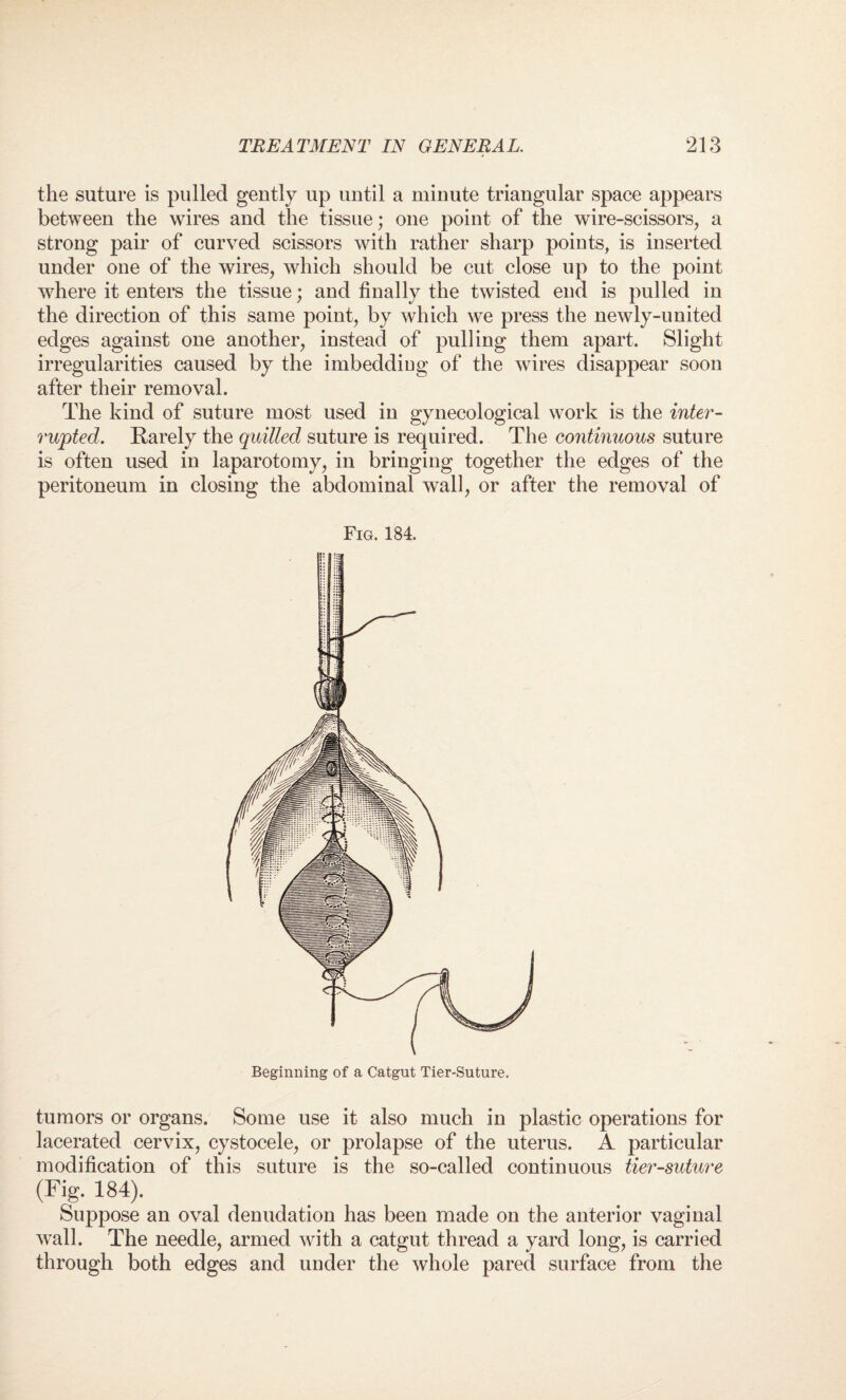 the suture is pulled gently up until a minute triangular space appears between the wires and the tissue; one point of the wire-scissors, a strong pair of curved scissors with rather sharp points, is inserted under one of the wires, which should be cut close up to the point where it enters the tissue; and finally the twisted end is pulled in the direction of this same point, by which we press the newly-united edges against one another, instead of pulling them apart. Slight irregularities caused by the imbedding of the wires disappear soon after their removal. The kind of suture most used in gynecological work is the inter- rwpted. Rarely the quilled suture is required. The continuous suture is often used in laparotomy, in bringing together the edges of the peritoneum in closing the abdominal wall, or after the removal of Fig. 184. • | Beginning of a Catgut Tier-Suture. tumors or organs. Some use it also much in plastic operations for lacerated cervix, cystocele, or prolapse of the uterus. A particular modification of this suture is the so-called continuous tier-suture (Fig. 184). Suppose an oval denudation has been made on the anterior vaginal wall. The needle, armed with a catgut thread a yard long, is carried through both edges and under the whole pared surface from the