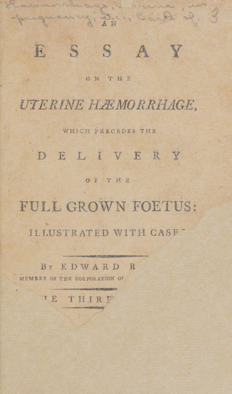 o* See SP Phen: Sete en — at o, o : ck Eee WER AL ON Sen : see = oe a, a : GN a cf wy ne = s : ae See SS B4 os ce OF : Ags Sees a Se ee ee ee ee oa road ak Sens ~ — Ry : eg Re ae eae Re < ae   UTERINE HEMORRHAGE, we Lie £8 FULL GROWN FOE TUS: IL LUS TRATED WITH CASF  -By EDWARD &amp; MEMBER OF THE CORPORATION OF 2 3 a le emenmsiaaaimmiuataniaagamanss 1k THIA? 