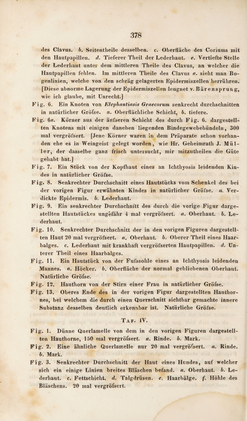 des Clavus. b. Seitentheile desselben, c. Oberfläche des Coriums mit den Hautpapillen, d. Tieferer Theil der Lederbaut. e. Vertiefte Stelle der Lederbaut unter dem mittleren Theile des Clavus, an welcher die Hautpapillen fehlen. Im mittleren Theile des Clavus a. sieht man Bo¬ genlinien, welche von den schräg gelagerten Epidermiszellen herrühren. [Diese abnorme Lagerung der Epidermiszellen leugnet v. Bär ensprung, wie ich glaube, mit Unrecht.] Fig. 6. Ein Knoten von Elephantiasis Graecorum senkrecht durchschnitten in natürlicher Grofse. «. Oberflächliche Schicht, b. tiefere. Fig. 6u. Körner aus der äufseren Schicht des durch Fig. 6. dargestell¬ ten Knotens mit einigen daneben liegenden Bindegewebebündeln, 300 mal vergröfsert. [Jene Körner waren in dem Präparate schon vorhan¬ den ehe es in Weingeist gelegt worden, wie Hr. Geheimrath J. Mül¬ ler, der dasselbe ganz frisch untersucht, mir mitzutheilen die Güte gehabt hat.] Fig. 7. Ein Stück von der Kopfhaut eines an Ichtliyosis leidenden Kin¬ des in natürlicher Gröfse. Fig. 8. Senkrechter Durchschnitt eines Hautstücks vom Schenkel des bei der vorigen Figur erwähnten Kindes in natürlicher Gröfse. a. Ver¬ dickte Epidermis, b. Lederhaut. Fig. 9. Ein senkrechter Durchschnitt des durch die vorige Figur darge¬ stellten Hautstückes ungefähr 4 mal vergröfsert. a. Oberhaut, b. Le¬ derhaut. Fig. 10. Senkrechter Durchschnitt der in den vorigen Figuren dargestell¬ ten Haut 20 mal vergröfsert. n. Oberhaut, b. Oberer Theil eines Haar¬ balges. c. Lederhaut mit krankhaft vergrÖfserten Hautpapillen, d. Un¬ terer Theil eines Haarbalges. Fig, 11, Ein Hautstück von der Fufssohle eines an Ichthyosis leidenden Mannes. «. Höcker, b. Oberfläche der normal gebliebenen Oberhaut. Natürliche Gröfse. Fig. 12. Hauthorn von der Stirn einer Frau in natürlicher Gröfse. Fig. 13. Oberes Ende des in der vorigen Figur dargestellten Haufchor- nes, bei welchem die durch einen Querschnitt sichtbar gemachte innere Substanz desselben deutlich erkennbar ist. Natürliche Gröfse. Taf. IV. Fig. 1. Dünne Querlamelle von dem in den vorigen Figuren dargestell¬ ten Hauthorne, 150 mal vergröfsert. a. Rinde. bc Mark. Fig. 2. Eine ähnliche Querlamelle nur 20 mal vergröfsert. a. Rinde. b. Mark. Fig. 3. Senkrechter Durchschnitt der Haut eines Hundes, auf welcher sich ein einige Linien breites Bläschen befand, a. Oberhaut, b. Le¬ derhaut. c. Fettschicht, d. Talgdrüsen, e. Haarbälge, f. Höhle des Bläschens. 20 mal vergröfsert.