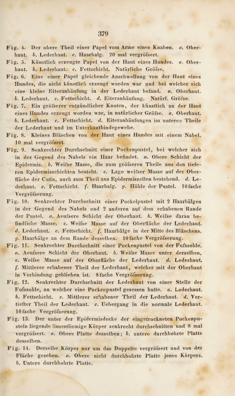 Fig. 4. Der obere Theil einer Papel vom Arme eines Knaben, a. Ober¬ haut. b. Lederhant. c. Haarbalg. 20 mal vergröfsert. Fig. 5. Künstlich erzeugte Papel von der Haut eines Hundes, a. Ober¬ haut. b. Lederhaut. c. Fettschicht. Natürliche Gröfse. Fig. 6. Eine einer Papel gleichende Anschwellung von der Haut eines Hundes, die nicht künstlich erzeugt worden war und bei welcher sich eine kleine Eiteranhäufung in der Lederhaut befand, n. Oberhaut. b. Lederhaut. c. Fettschicht, d. Eiteranhäufung. Natiirl. Gröfse. Fig. 7. Ein gröfserer entzündlicher Knoten, der künstlich an der Haut eines Hundes erzeugt worden war, in natürlicher Gröfse. u. Oberhaut. b. Lederhaut. c. Fettschicht, d. Eiteranhäufungen im unteren Theile der Lederhaut und im Unterhautbindegewebe. Fig. 8. Kleines Bläschen von der Haut eines Hundes mit einem Nabel. 10 mal vergröfsert. Fig. 9. Senkrechter Durchschnitt einer Pockenpustel, bei welcher sich in der Gegend des Nabels ein Haar befindet, et. Obere Schicht der Epidermis, b. Weifse Masse, die zum grÖfseren Theile aus den tiefe¬ ren Epidermisschichten besteht, c. Lage weifser Masse auf der Ober¬ fläche der Cutis, auch zum Theil aus Epidermiszellen bestehend, d. Le¬ derhaut. e. Fettschicht, f. Haarbalg. g. Höhle der Pustel. lOfache Vergröfserung. Fig. 10. Senkrechter Durchschnitt einer Pockelpustel mit 2 Haarbälgen in der Gegend des Nabels und 2 anderen auf dem erhabenen Rande der Pustel, a. Aeufsere Schicht der Oberhaut, b. Weifse daran be¬ findliche Masse, c. Weifse Masse auf der Oberfläche der Lederhaut. d. Lederhaut. c. Fettschicht, f. Haarbälge in der Mitte des Bläschens, g. Haarbälge an dem Rande desselben. lOfache Vergröfserung. Fig. 11. Senkrechter Durchschnitt einer Pockenpustel von der Fufssohle, n. Aeufsere Schicht der Oberhaut, b. Weifse Masse unter derselben» c. Weifse Masse auf der Oberfläche der Lederhaut. d. Lederhaut, f. Mittlerer erhabener Theil der Lederhaut, welcher mit der Oberhaut in Verbindung geblieben ist. 8fache Vergröfserung. Fig. 12. Senkrechter Durchschnitt der Lederhaut von einer Stelle der Fufssohle, an welcher eine Pockenpustel gesessen hatte, a. Lederhaut. b. Fettschicht, c. Mittlerer erhabener Theil der Lederhaut. d. Ver¬ tiefter Theil der Lederhaut. e. Uebergang in die normale Lederhaut. lOfache Vergröfserung. Fig. 13. Der unter der Epidermisdecke der eingetrockneten Pockenpu¬ steln liegende linsenförmige Körper senkrecht durchschnitten und 8 mal vergröfsert. a. Obere Platte desselben; b. untere durchbohrte Platte desselben. Fig. 14. Derselbe Körper nur um das Doppelte vergröfsert und von der Fläche gesehen, a. Obere nicht durchbohrte Platte jenes Körpers. b. Untere durchbohrte Platte,