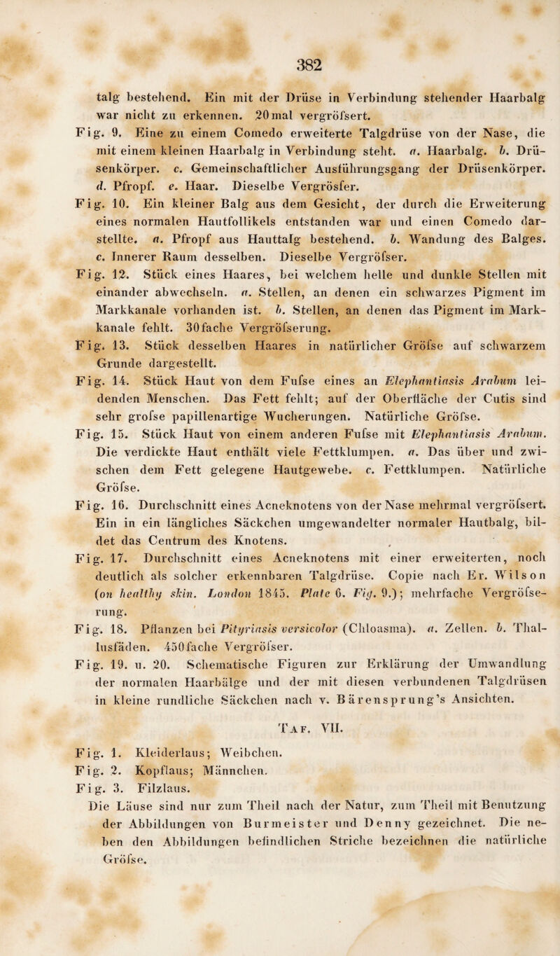 talg bestehend. Ein mit der Drüse in Verbindung stehender Haarbalg war nicht zu erkennen. 20mal vergröfsert. Fig. 9. Eine zu einem Coinedo erweiterte Talgdrüse von der Nase, die mit einem kleinen Haarbalg in Verbindung steht, a. Haarbalg. b. Drü¬ senkörper. c. Gemeinschaftlicher Ausführungsgang der Drüsenkörper. d. Pfropf, e. Haar. Dieselbe VergrÖsfer. Fig. 10. Ein kleiner Balg aus dem Gesicht, der durch die Erweiterung eines normalen Hautfollikels entstanden war und einen Comedo dar¬ stellte. (t. Pfropf aus Hauttalg bestehend, b. Wandung des Balges. c. Innerer Raum desselben. Dieselbe Vergröfser. Fig. 12. Stück eines Haares, bei welchem helle und dunkle Stellen mit einander abwechseln, a. Stellen, an denen ein schwarzes Pigment im Markkanale vorhanden ist. b. Stellen, an denen das Pigment im Mark- kanale fehlt. 30 fache Vergröfserung. Fig. 13. Stück desselben Haares in natürlicher Gröfse auf schwarzem Grunde dargestellt. Fig. 14. Stück Haut von dem Fufse eines an Elephantiasis Arabum lei¬ denden Menschen. Das Fett fehlt; auf der Oberfläche der Cutis sind sehr grofse papillenartige Wucherungen. Natürliche Gröfse. Fig. 15. Stück Haut von einem anderen Fufse mit Elephantiasis Arabum. Die verdickte Haut enthält viele Fettklumpen, a. Das über und zwi¬ schen dem Fett gelegene Hautgewebe, c. Fettklumpen. Natürliche Grofse. Fig. 16. Durchschnitt eines Acneknotens von der Nase mehrmal vergröfsert. Ein in ein längliches Säckchen umgewandelter normaler Hautbalg, bil¬ det das Centrum des Knotens. Fig. 17. Durchschnitt eines Acneknotens mit einer erweiterten, noch deutlich als solcher erkennbaren Talgdrüse. Copie nach Er. Wilson (on healtlnj skin. London 1845. Plate 6. Fig. 9.); mehrfache Vergröfse¬ rung. Fig. 18. Pflanzen bei Pityriasis versicolor (Chloasma), a. Zellen, b. Thal¬ lusfäden. 450fache Vergröfser. Fig. 19. u. 20. Schematische Figuren zur Erklärung der Umwandlung der normalen Haarbälge und der mit diesen verbundenen Talgdrüsen in kleine rundliche Säckchen nach v. B ärenspr ung’s Ansichten. Taf, VII. Fig. 1. Kleiderlaus; Weibchen. Fig. 2. Kopflaus; Männchen. Fig. 3. Filzlaus. Die Läuse sind nur zum Theil nach der Natur, zum Theil mit Benutzung der Abbildungen von Burmeister und Denny gezeichnet. Die ne¬ ben den Abbildungen befindlichen Striche bezeichnen die natürliche Gröfse.
