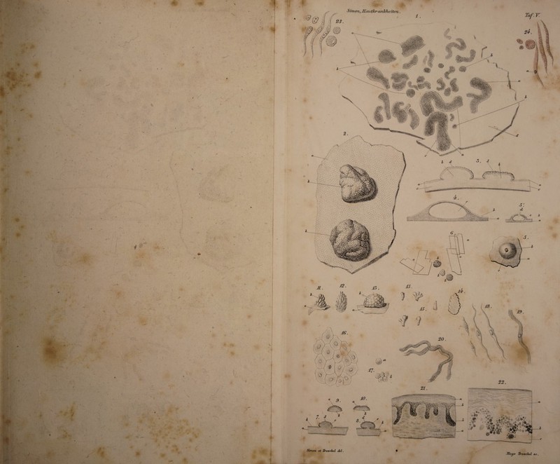 \ V f* % u ' I f *4 Vy^ y « V AY- ) ! \ -t « l Simon, et Troachel del. % Simon, Hautkvmileheiten ■$0! (r,*!S*0**ä*@ »fV'/.v.; f&e ***** *» '«MH*. Rn c/o Troachel ae
