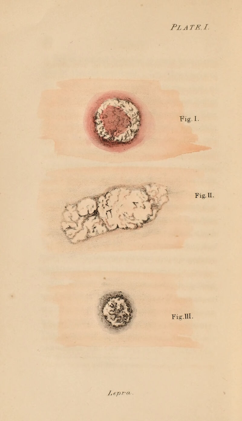 Plate. I. Fig. II. J.epra