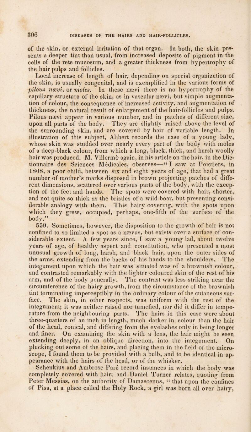 of the skin, or external irritation of that organ. In both, the skin pre¬ sents a deeper tint than usual, from increased deposite of pigment in the cells of the rete mucosum, and a greater thickness from hypertrophy of the hair pulps and follicles. Local increase of length of hair, depending on special organization of the skin, is usually congenital, and is exemplified in the various forms of pilous nxvi, or moles. In these naevi there is no hypertrophy of the capillary structure of the skin, as in vascular naevi, but simple augmenta¬ tion of colour, the consequence of increased activity, and augmentation of thickness, the natural result of enlargement of the hair-follicles and pulps. Pilous naevi appear in various number, and in patches of different size, upon all parts of the body. They are slightly raised above the level of the surrounding skin, and are covered by hair of variable length. In illustration of this subject, Alibert records the case of a young lady, whose skin was studded over nearly every part of the body with moles of a deep-black colour, from which a long, black, thick, and harsh woolly hair was produced. M. Villerme again, in his article on the hair, in the Dic- tionnaire des Sciences Medicales, observes—“ I saw at Poictiers, in 1808, a poor child, between six and eight years of age, that had a great number of mother’s marks disposed in brown projecting patches of diffe¬ rent dimensions, scattered over various parts of the body, with the excep¬ tion of the feet and hands. The spots were covered with hair, shorter, and not quite so thick as the bristles of a wild boar, but presenting consi¬ derable analogy with them. This hairy covering, with the spots upon which they grew, occupied, perhaps, one-fifth of the surface of the body.” 559. Sometimes, however, the disposition to the growth of hair is not confined to so limited a spot as a naevus, but exists over a surface of con¬ siderable extent. A few years since, I saw a young lad, about twelve years of age, of healthy aspect and constitution, who presented a most unusual growth of long, harsh, and black hair, upon the outer sides of the arms, extending from the backs of his hands to the shoulders. The integument upon which the hair was situated was of a brownish colour, and contrasted remarkably with the lighter coloured skin of the rest of his arm, and of the body generally. The contrast was less striking near the circumference of the hairy growth, from the circumstance of the brownish tint terminating imperceptibly in the ordinary colour of the cutaneous sur¬ face. The skin, in other respects, was uniform with the rest of the integument; it was neither raised nor tumefied, nor did it differ in tempe¬ rature from the neighbouring parts. The hairs in this case were about three-quarters of an inch in length, much darker in colour than the hair of the head, conical, and differing from the eyelashes only in being longer and finer. On examining the skin with a lens, the hair might be seen extending deeply, in an oblique direction, into the integument. On plucking out some of the hairs, and placing them in the field of the micro¬ scope, I found them to be provided with a bulb, and to be identical in ap¬ pearance with the hairs of the head, or of the whisker. Schenkius and Ambrose Pare record instances in which the body was completely covered with hair; and Daniel Turner relates, quoting from Peter Messias, on the authority of Damascenus, “ that upon the confines of Pisa, at a place called the Holy Rock, a girl was born all over hairy,