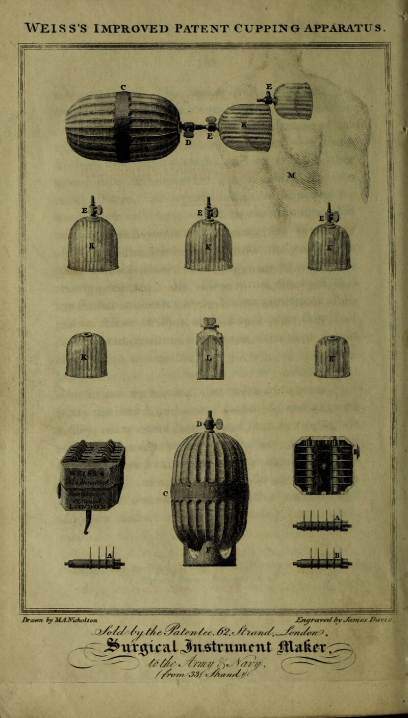 WEISS'S IMPROVED PATENT CUPPING APPARATUS. Drawn by ALA-NuhaUon IV JZnyrayet/by Jhrries Dovis. /'ty //f - jC//r // /rr. l)2.- //y/tnt/',^S<rn</o/i9 . j&urc$iealinstrument Jtla&er ^ - //■///// . ( /front flrr/tr//<