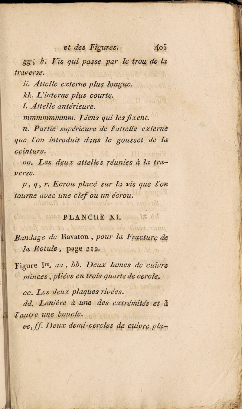 gg\ h: Vis qui passe par le trou de la traverse. ii. Attelle externe plus longue« kit. L'interne plus courte. I. Attelle antérieure. mmmmmmmm. Liens qui lesfixent. n. Partie supérieure de l'attelle externe que Von introduit dans le gousset de la ceinturef oo. Les deux attelles réunies à la tra¬ verse. p, q, r. Ecrou placé sur la vis que Von tourne avec une clef ou un écrou. PLANCHE XL Bandage de Ravaton, pour la Fracture de la Rotule, page 212. Figure lre, aa, bb. Deux lames de cuivre minces, pliées en trois quarts de cercle. 11 cc. Les deux plaques rivées. dd. Lanière à une des extrémités et à 1 J Vautre une boucle. ce, ff. Deux demi-cercles de cuivre pla- 1