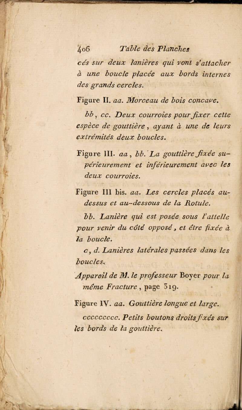 cés sur deux lanières qui vont s’attacher à une boucle -placée aux bords internes des grands cercles. Figure II. aa. Morceau de bois concave. ' f ' , .1 bb, cc. Deux courroies pour fixer cette espèce de gouttière, ayant à une de leurs extrémités deux boucles. Figure III. aa, bb. La gouttière fixée su¬ périeurement et inférieurement avec les deux courroies. Figure III bis. aa. Les cercles placés au- dessus et au-dessous de la Rotule. bb. Lanière qui est posée sous Vattelle pour venir du côté opposé, et être fixée à la boucle. c, d. Lanières latérales passées dans les boucles\ Appareil de M. le professeur Boyer pour la même Fracture , page 319. Figure iy. aa. Gouttière longue et large. ccccccccc. Petits boutons droitsfixés sur les bords de la gouttière. y