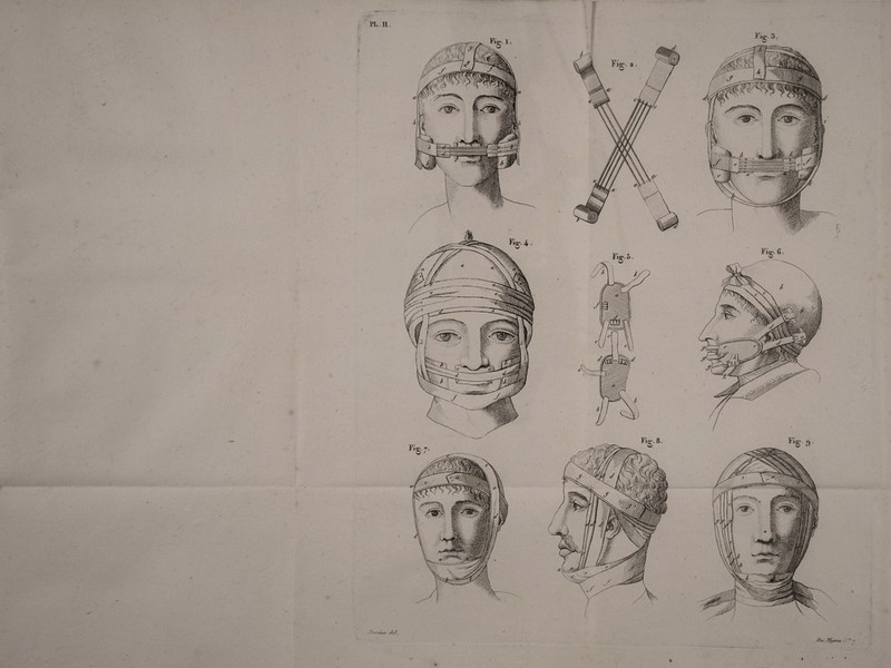 No text description is available for this image