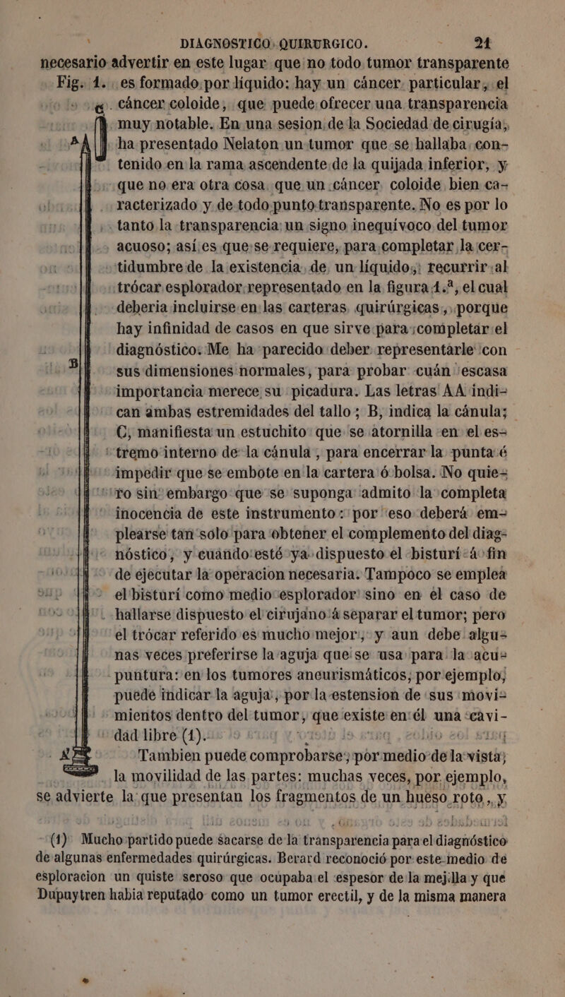 necesario advertir en este lugar que no todo tumor transparente Fig. 4... es formado.por líquido: hay un cáncer. particular, el sw. cáncer coloide, que puede ofrecer una transparencia | muy notable. En una sesion dela Sociedad de cirugía; ha presentado Nelaton un tumor quese hallaba. con- tenido en la rama ascendente de la quijada inferior, y que no era otra cosa. que un cancer, coloide bien ca- racterizado y de todo punto transparente. No es por lo . tanto la transparencia: un signo inequívoco del tumor acuoso; así.es quese requiere, para completar la cer- -tidumbre de la existencia, de, un liquido;: recurrir:al trócar esplorador.representado en la figura 4.2, el cual deberia incluirse en:las carteras quirúrgicas, porque hay infinidad de casos en que sirve. para ;completar:el diagnóstico. Me ha parecido deber representarle con sus dimensiones normales, para probar cuán 'escasa importancia merece su picadura. Las letras AA indi- can ambas estremidades del tallo; B, indica la cánula; €, manifiesta: un estuchito que se atornilla en el es- ‘‘tremo interno de la cánula , para encerrar la punta é impedir que se embote en la cartera ó-bolsa. No quie= | ‘fo sin’ embargo que se suponga admito la completa inocencia de este instrumento: por “eso deberá em- plearse tan'solo para obtener el complemento del diag- nóstico, y cuando:esté ya dispuesto el bisturi: à fin de ejecutar la operacion necesaria. Tampoco se emplea el bisturí como medio esplorador' sino en el caso de -. hallarse dispuesto el cirujano:4 separar el tumor; pero el trócar referido es mucho mejor, y aun debe algu= nas veces preferirse la aguja quese ‘usa para la acu -puntura: en los tumores aneurismáticos; por ejemplo, puede indicar la aguja, por la-estension de ‘sus movi: mientos dentro del tumor, es existe en él una ‘Ca vi- dad libre (1). | | f Tambien puede Poe à pe pô: «mio de la vistás la movilidad de las partes: muchas veces, por ejemplo, se Monte la que presentan los fragmentos de un hueso roto, y (1) AMO partido pida Sacatse de la dias podia] para elidiagirásticó de algunas enfermedades quirúrgicas. Berard reconoció per este-medio de esploracion un quiste seroso que ocupaba: el :espesor dela mej:lla y que Dupuytren habia reputado como un tumor erectil, y de la misma manera