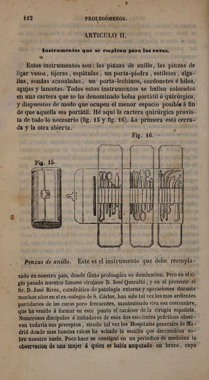 po 419 | | PROLEGOMENOS. ARTICULO I. Instrumentos que se emplean para las euras, ES Estos instrumentos son: las pinzas de anillo, las pinzas de ligar vasos, tijeras , espátulas , un porta-piedra , estiletes , alga- lias, sondas acanaladas, un porta-lechinos, cordonetes é hilos, agujas y lancetas. Todos estos instrumentos se hallan colocados en una cartera que se ha denominado bolsa portátil ó quirúrgica, y dispuestos de modo que ocupen el menor espacio posible à fin de que aquella sea portátil. Hé aquí la cartera quirúrgica provis- ta de todo lo necesario (fig. 15 y fig. 16). La primera está cerra- da y la otra abierta. y» | ás a PA = O) O A 1170222092 O e e e _ y o NE RE nia cra o nn Pinzas de anillo. Este es el instrumento que debe reempla- vado en nuestro pais, donde tánto prolongára su dominacion. Pero en el si- glo pasado nuestro famoso cirujano D. José Queralt6 , y en el presente el Sr. D. José Rives, catedrático de patología externa y operaciones durante muchos años en el ex-colegio de S. Gärlos, han sido tal vez los mas ardientes partidarios de las curas poco frecuentes, manteniendo viva esa costumbre, que ha venido á formar en este punto el carácter de la cirugia española. Numerosos discipulos é imitadores de esos dos escelentes prácticos obser- van todavía sus preceptos , siendo tal vez los Hospitales generales de Ma: drid donde mas hondas raices ha echado la semilla que derramáran so- bre nuestro suelo, Poco hace se consignó en un periódico de medicina la observacion de una mujer á quien se habia amputado un brazo, cuyo