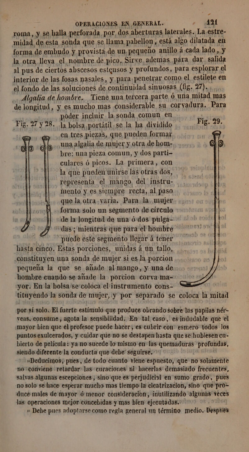 roma, y se balla perforada, por, dos aberturas laterales. La estre- midad de esta sonda que se llama, pabellon, está algo dilatada en forma de embudo y provista de un, pequeño anillo à. cada lado, y la otra lleva el. nombre de pico. Sirve, ademas para dar salida al pus de ciertos abscesos estgusos y profundos, para esplorar « el interior de las fosas nasales, y para penetrar como el estilete en el fondo de las soluciones de continuidad sinuosas (fig. 27 ais M Algalia de hombre. Tiene una tercera parte 6 una mitad 1 mas de longitud, y es mucho mas considerable su corvadura. Para poder incluir. la sonda comun en. Fig. 27 ÿ28. 1a bolsa portátil,se la ha dividido | en tres piezas, que pueden formar una algalia de mujer y otra de bom- bre; una pieza comun, y dos parti- culares ó picos. La primera, con la que pueden unirse las otras dos, representa el mango, del instru- mento y es siempre recta, al paso que la otra varía. Para. la. mujer. +. forma solo un ségmento de circulo + de la: longitud de una 6 dos pulga- “das; mientras que para el hombre puede este segmento logar à tener hasta cinco. Estas porciones, unidas 4 un tallo, constituyen una sonda de mujer sies la porcion pequeña la que se añade al mango, y una de; hombre cuando se añade la porcion corva ma-: yor. En la bolsa’se-coloca el instrumento cons- he mi la sonda de ts gr y por separado se coloca la mitad por si sola. El fuerte eotíciobd que produce obrando sobre lis papilas nér- veas. consume, agota la sensibilidad. En tal caso, es indudable que el .mayor bien que el profesor puede hacer, es cubrir con: esmero todos los puntos exulcerados, y cuidar que no se destapen' hasta que se: hubiesen cu- bierto de película : ya no:sucede lo mismo en las: x noia profundas, siendo diferente la conducta que debe” seguirse. '»Deducimos; pues, de todo cuanto viene espuesto, que’ no solamente no conviené retardar las curaciones ni hacerlas: demasiado frecuentes, salvas.algunas escepciones ; sino'que es perjudicial en sumo grado, pues no solo se hace esperar mucho mas tiempo: la cicatrizacion, sino que pro- duce males de mayor ó menor consideracion, inutilizando “algunas veces las: operaciones mejor concebidas y mas bien ejecutadas. » Debe pues adoptarse como regla general un término medio. bytes